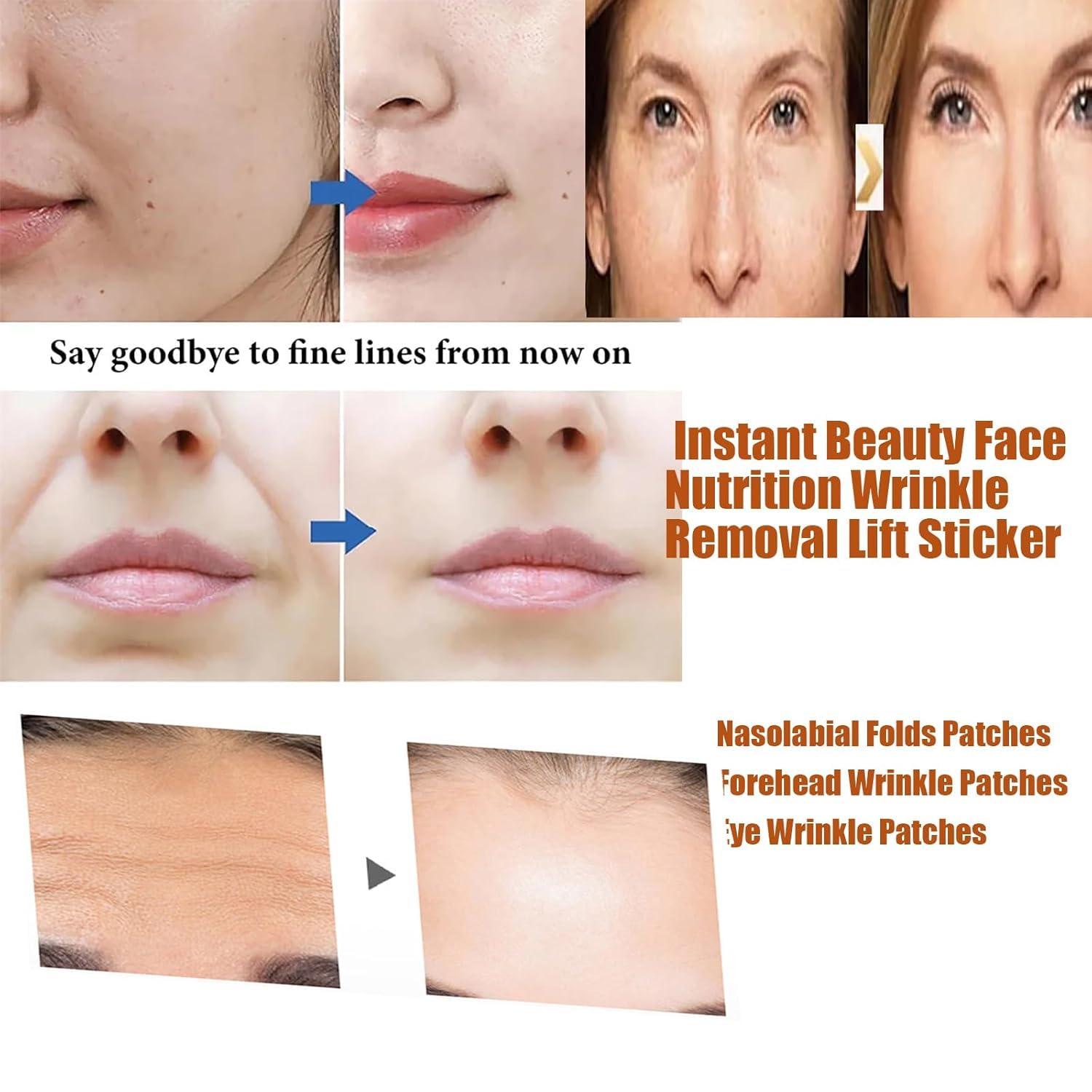 HIDRUO Instant Beauty Face Nutrition Wrinkle Removal Lift Sticker,Face Lift Mask, Microcrystalline Nasolabial Folds Removal Mask,For All Skin (Eye Patch, 3 box)