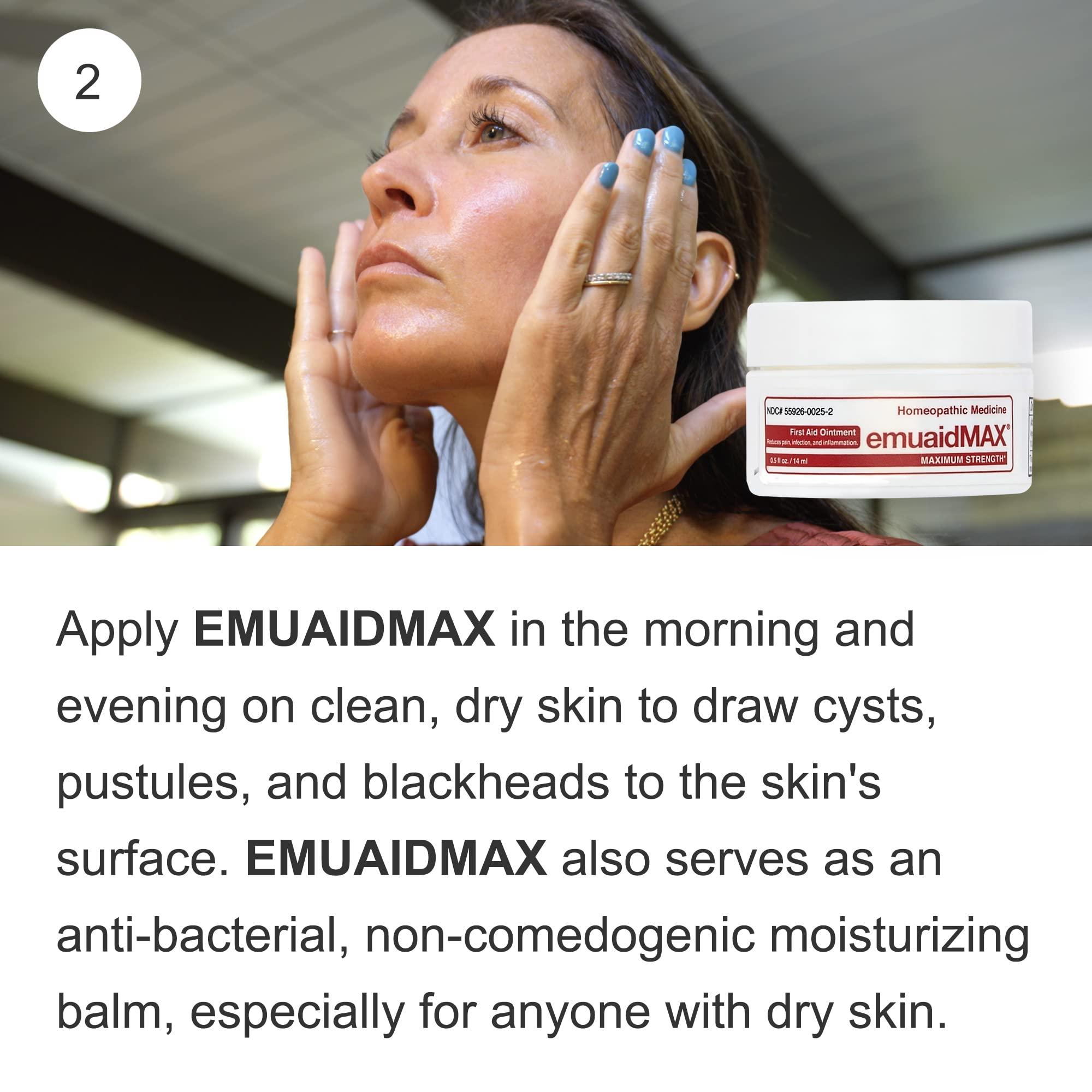 emuaid EMUAID Acne Erasing Trio, Therapeutic Moisture Bar, Overnight Acne Treatment, and EMUAIDMAX First Aid Ointment, Calms Cystic Acne, Reduces Acne Scars, Spots, and Blackheads Overnight
