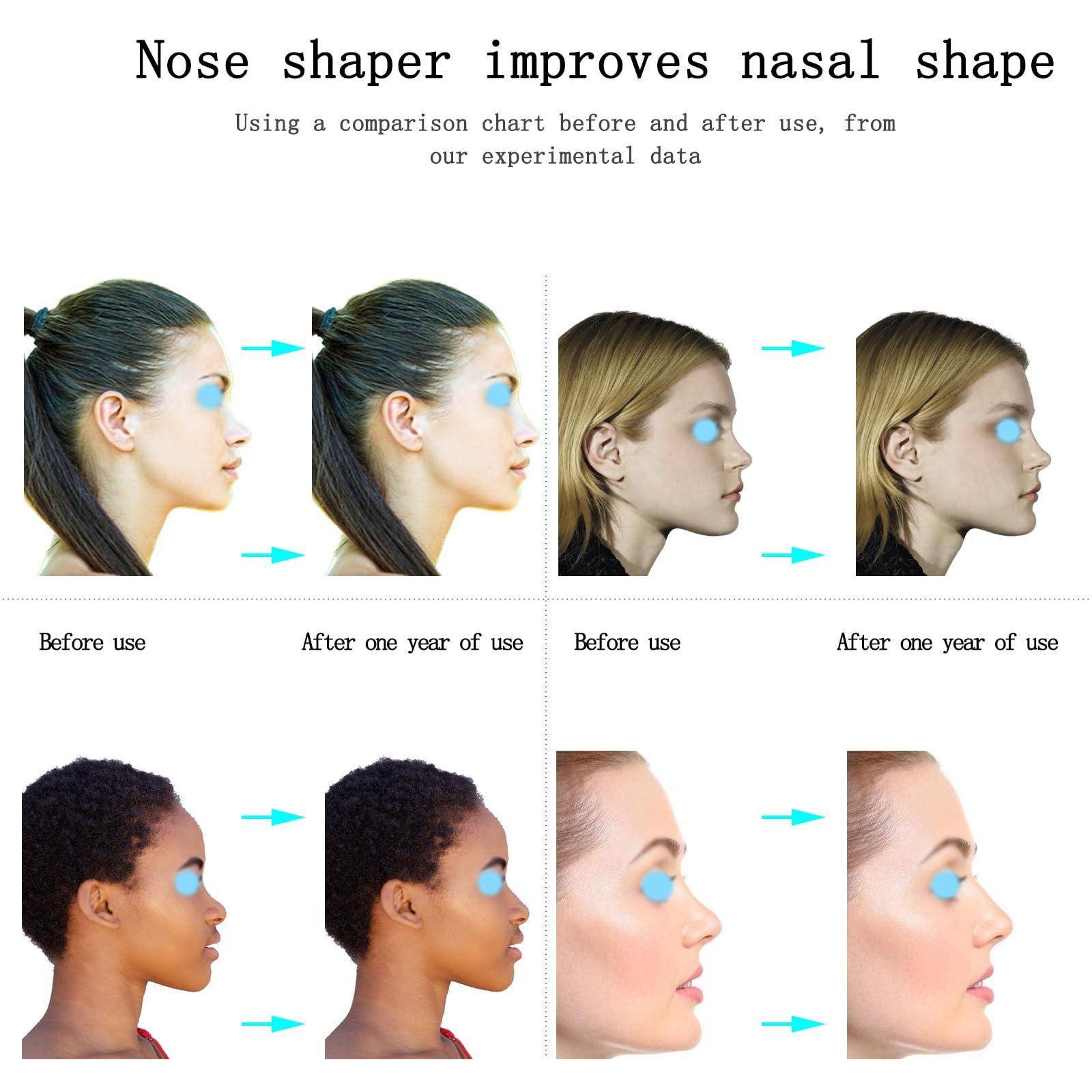 jieri Jieri Nose Shaper Lifter Clip - Reshape & Straighten Wide Noses for Men & Women