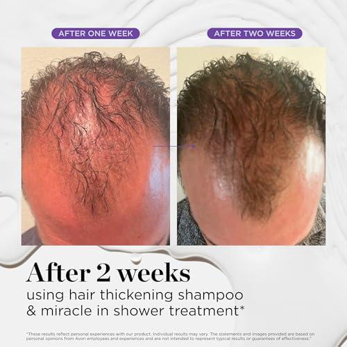 Dr. Groot Dr. Groot Hair Thickening Shampoo, Korean Hair Care with Biotin, Rosemary Oil to help Volumize Thinning, Damaged Hair, Hydrate Hair and Scalp, Biotin Shampoo,Scalp Revitalizing Solution