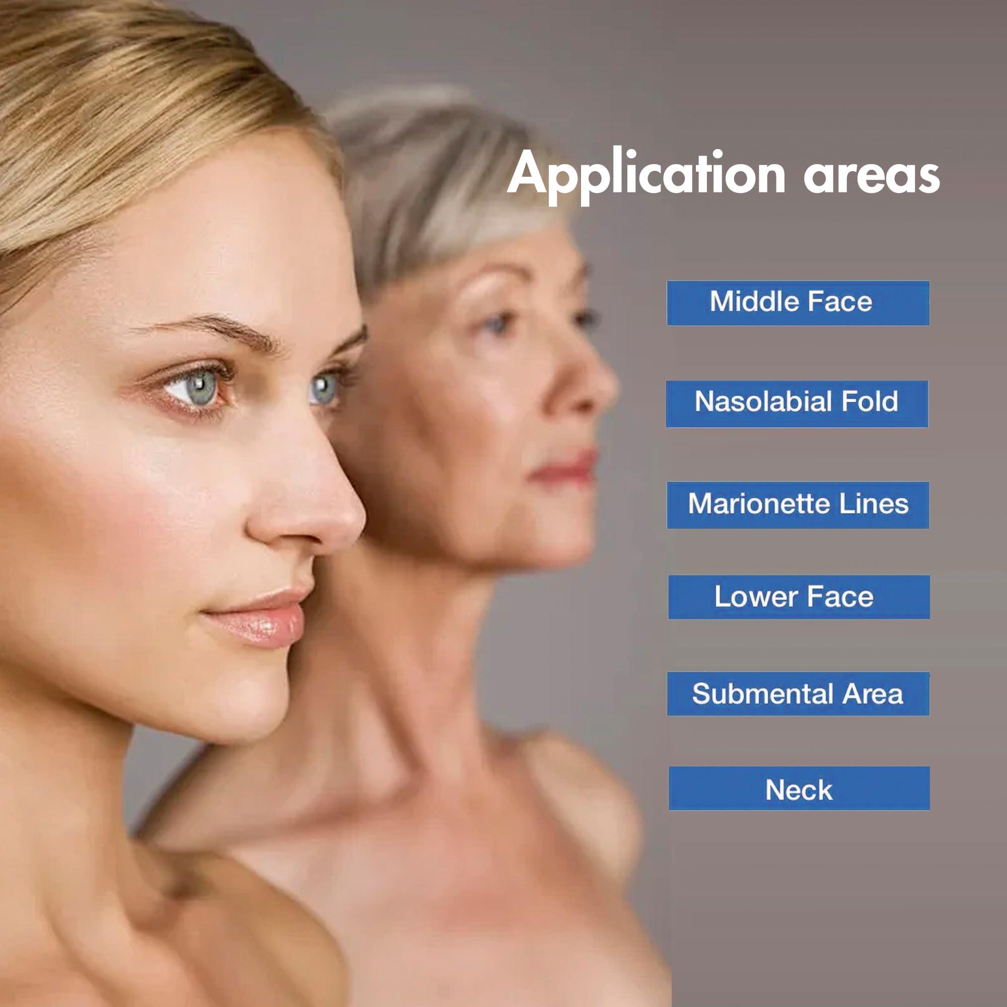 ESTEVO ESTEVO PDO Multi-Thread L-Type Blunt, Multiple PDO Mono Line Threads for Facial Filling (16PCS-23G*38mm)