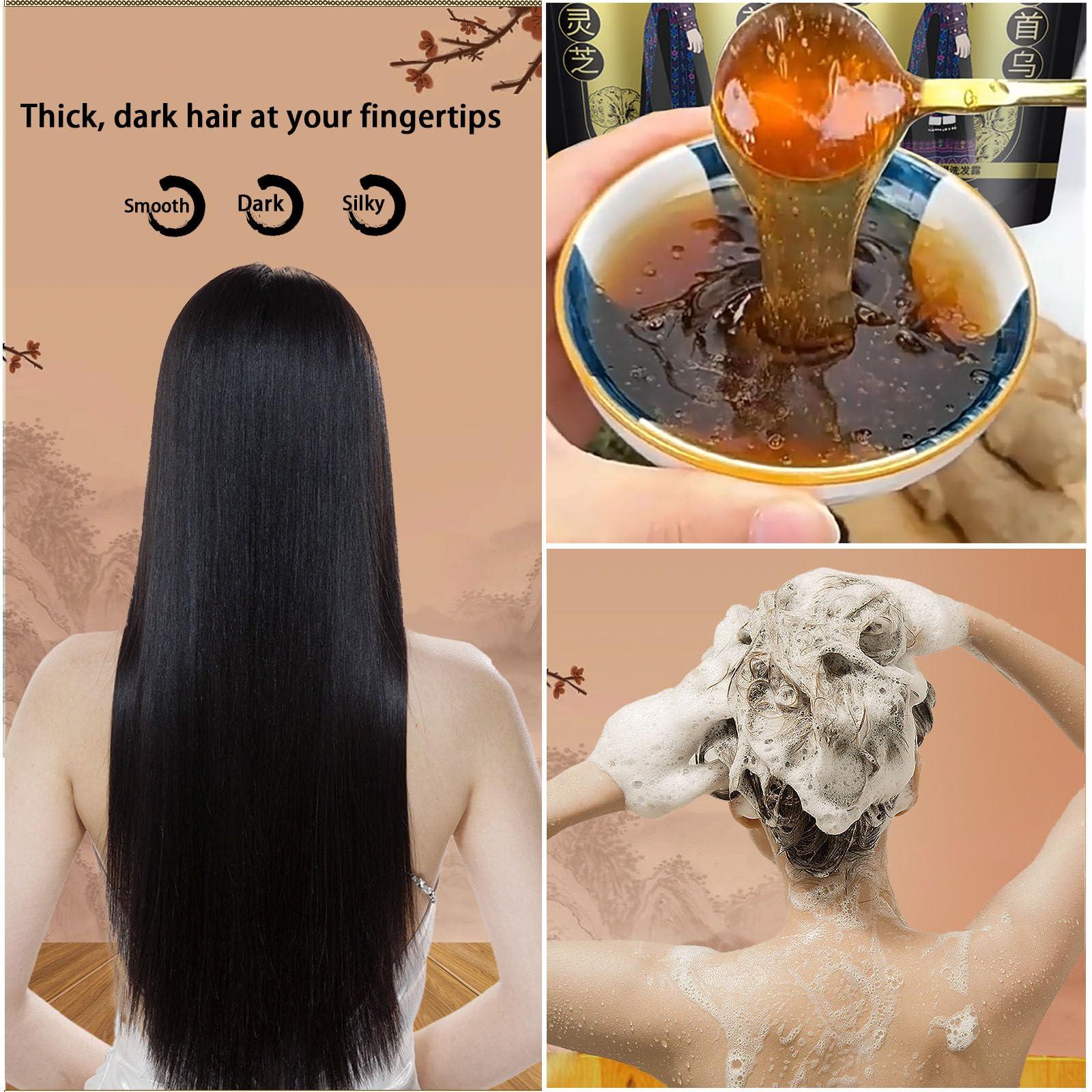 Nichalous 2PCS Ginger Plant Extract Anti-Hair Loss Hair Shampoo, Polygonum Black Ganoderma Extract Shampoo [2024 New Upgrade] (A (240mL+240mL/2Boxes))