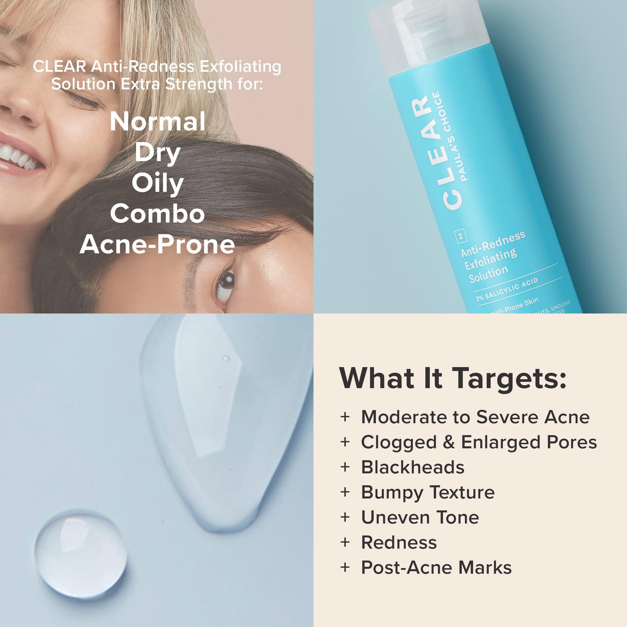 Paula's Choice Paula's Choice CLEAR Extra Strength Exfoliator, 2% Salicylic Acid Exfoliant for Acne, Redness Relief, 4 Ounce