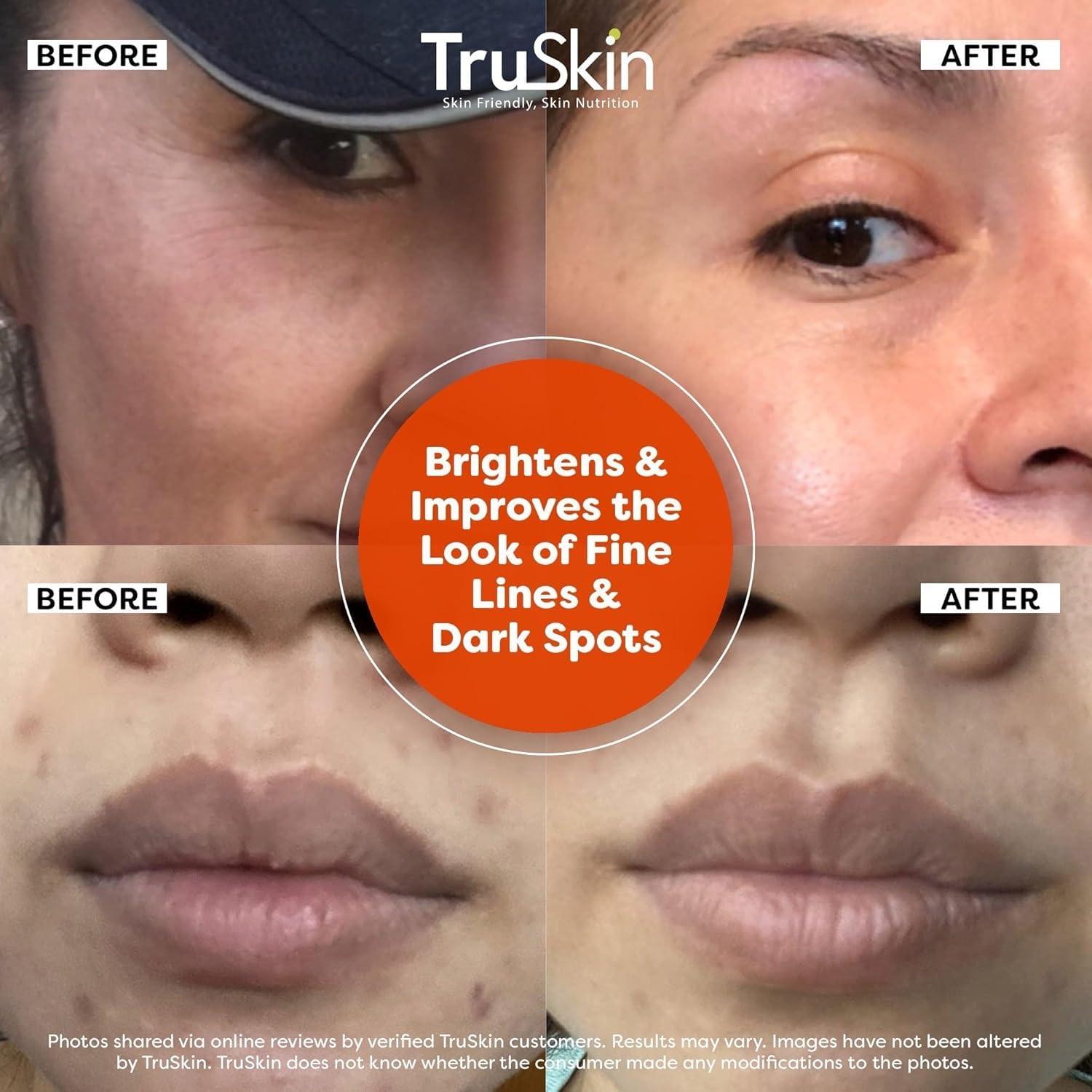 TruSkin Naturals TruSkin Vitamin C Serum For Face Anti Aging Formula with Vitamin C, Hyaluronic Acid, Vitamin E Brightening Serum Improve Appearance of Dark Spots, Tone, Fine Lines & Wrinkles, 1 Fl Oz