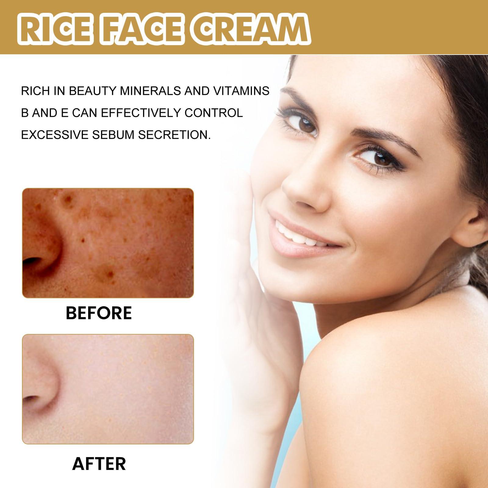 PEYNIR PEYNIR 1/2/3/5pcs crema de arroz para blanquear la piel,crema para las manchas de la cara,Cremas para Las Manchas de La Cara Oscuras, crema de arroz para la cara blanquear (2pcs,50ml)