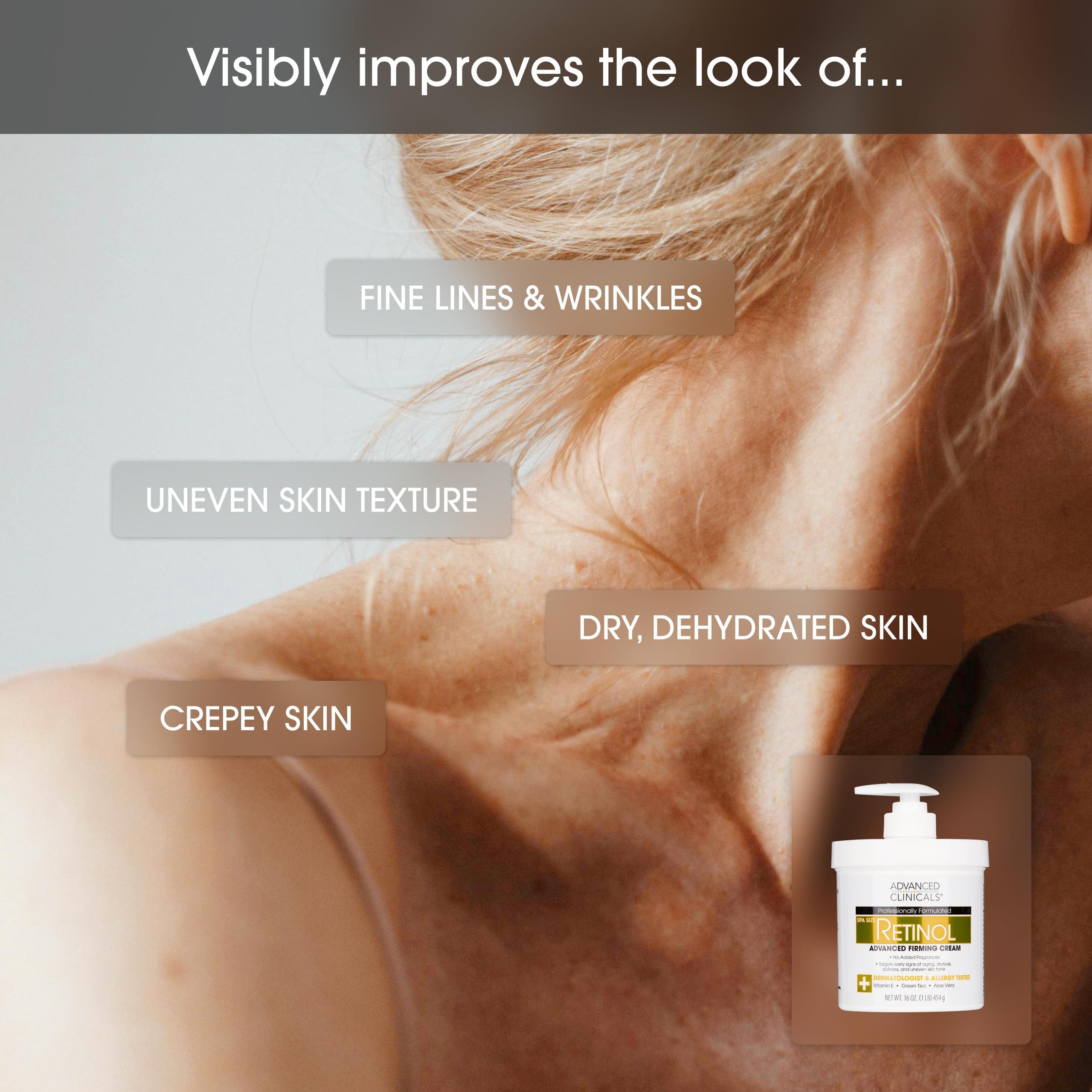 Advanced Clinicals Advanced Clinicals Retinol Body Lotion & Face Moisturizer | Visible Anti Aging Skin Care Retinol Body Cream For Women & Men Targets Look Of Fine Lines, Wrinkles & Crepe Looking Dry Skin, 16OZ, 2-Pack