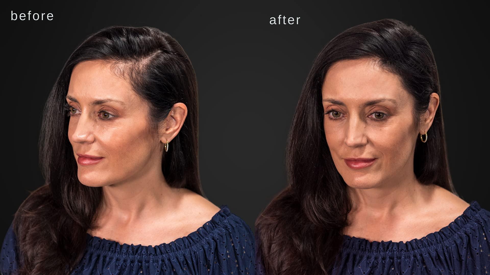 LUXE Professional LUXE Hair Thickening Fibers - CONFIDENCE IN A JAR – 2 Months+ Supply! – Hypoallergenic, Dermatologist Tested – Multiple Colors Available (Dark Brown)