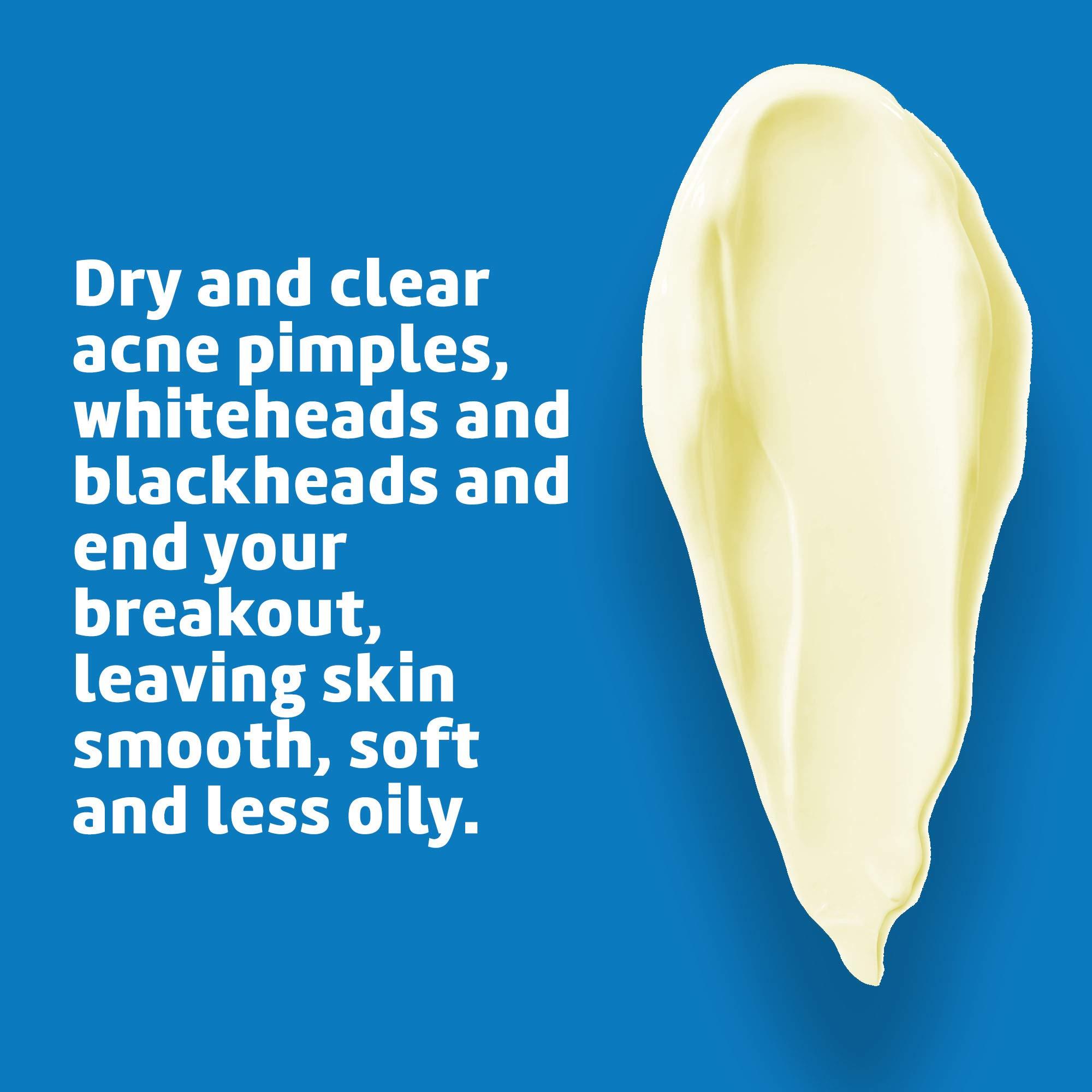 De La Cruz De La Cruz 5% Sulfur Ointment - Cystic Acne Treatment for Face and Body - Daily 10 Min Spot Treatment Mask - Safe and Effective Game Changing Hormonal Acne Treatment that Clears Up Pimples 2.6oz Tube