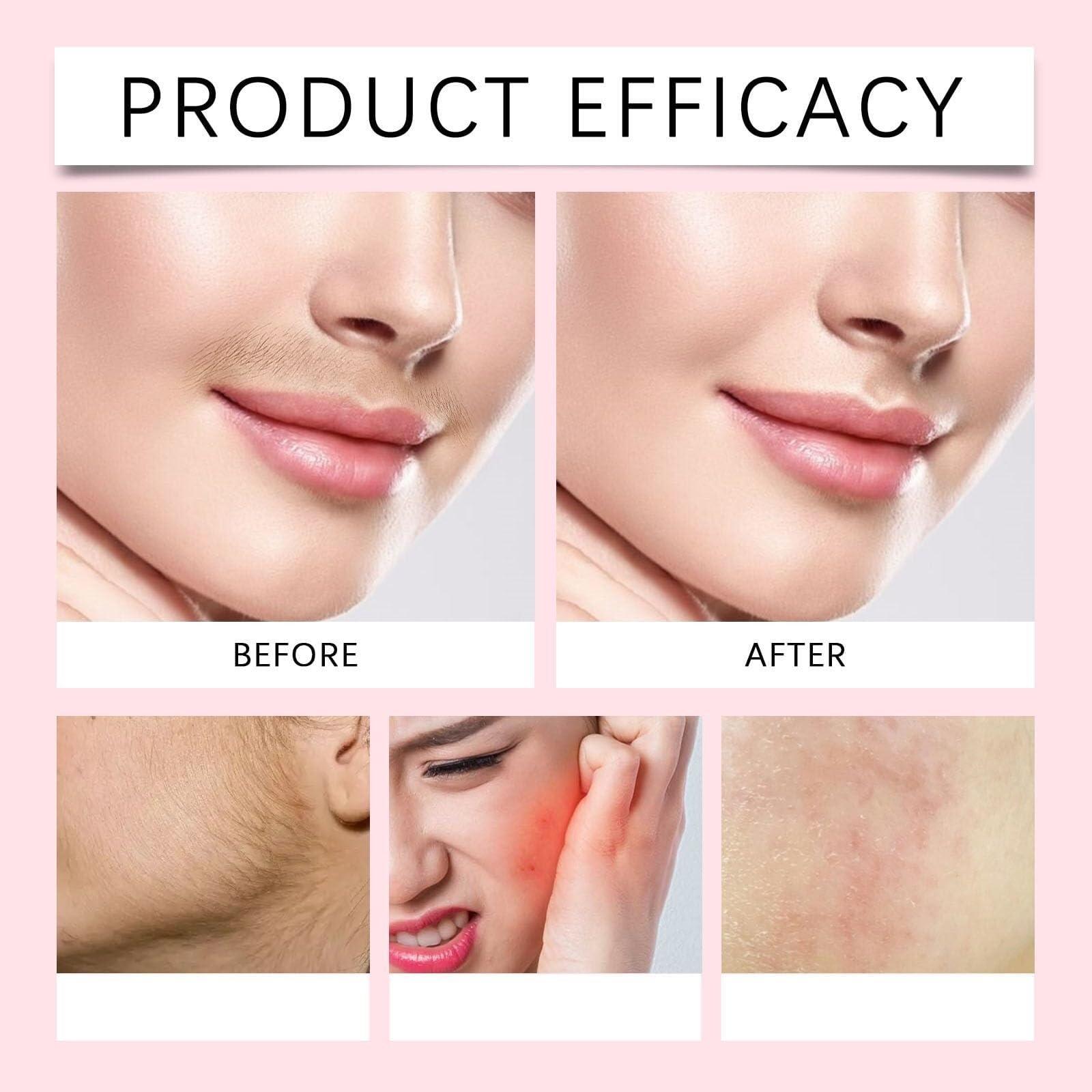 HNFYSMQL Vlyme Beard-Be-Gone Kit, Silklip Hair Removal Kit, Vlyme Beard Be Gone Cream, Liorabeauty Glide & Go Hair Removal Kit, Silklip Facial Hair Removal Cream for Women Men, Lasting Smooth Skin(3SET)