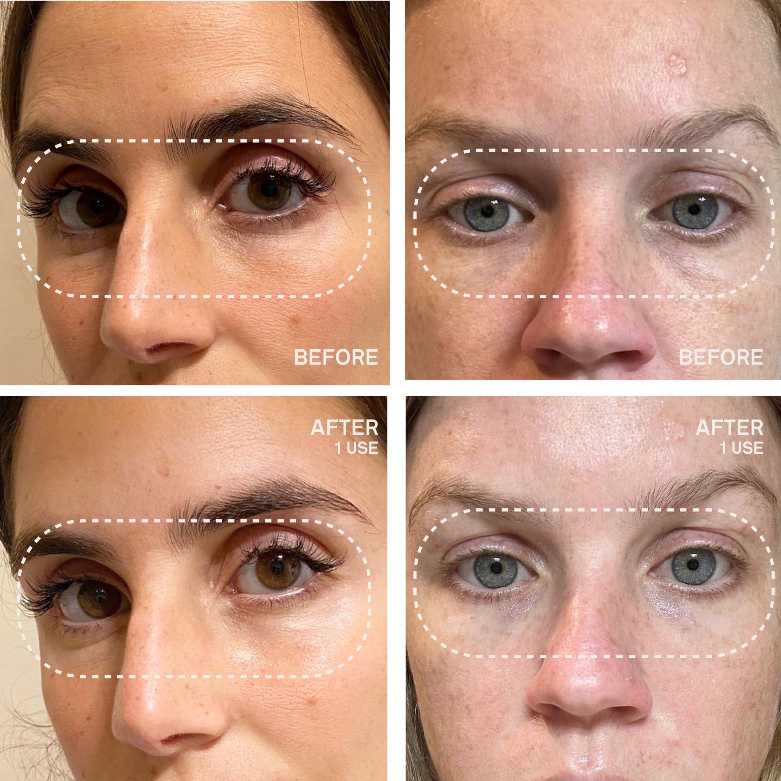 Dermaclara Dermaclara Silicone Face Patches - Anti-Wrinkle, Facial Mouth & Eye Patches - Hypoallergenic, Dermatologist Tested, Medical Grade Silicone Patches for Fine Lines & Wrinkles - Reusable up to 30 Uses