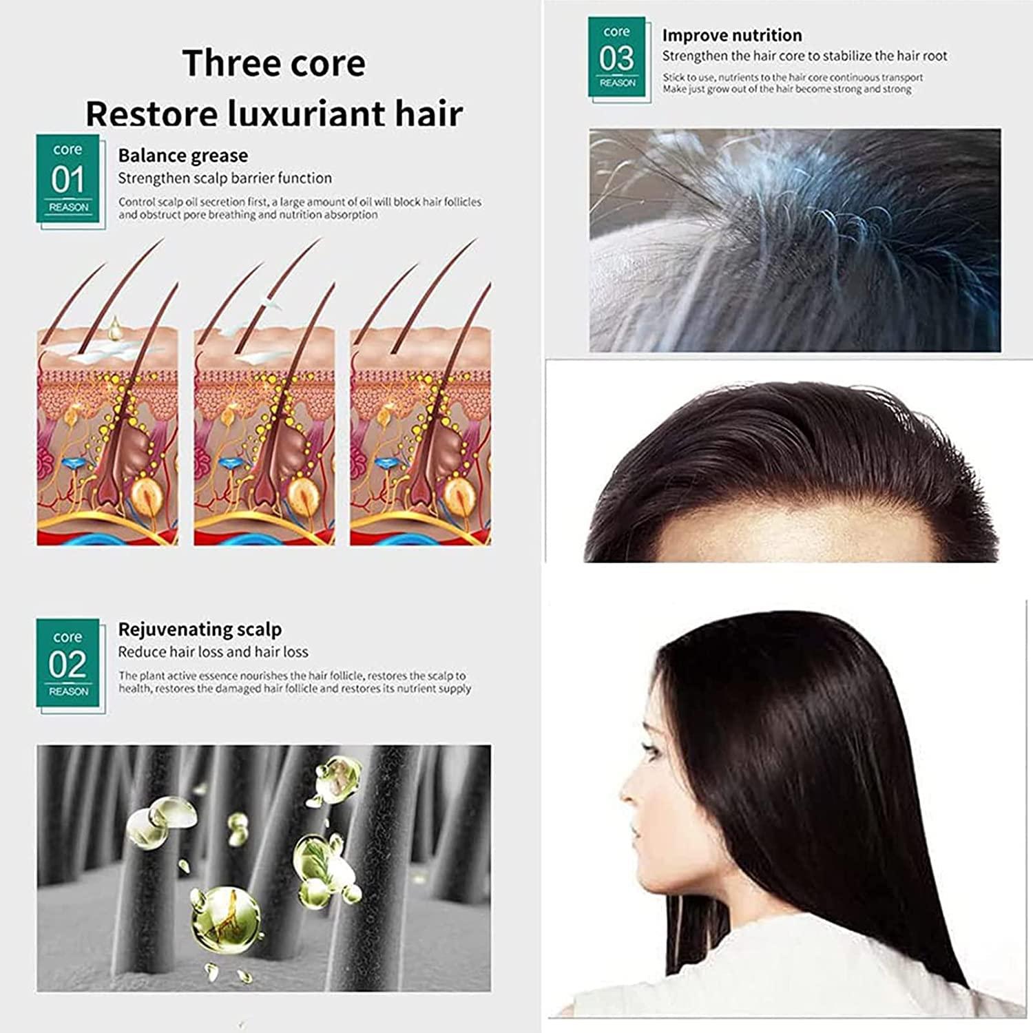 Peehss ShougaGRO Japanese Hair Growth Spray, Korean Ginseng Serum Spray, HyunGang Korea Ginseng Hair Regrowth Serum, Hair Regrowth Essence for for Women & Men, 30ml (2 Bottles)