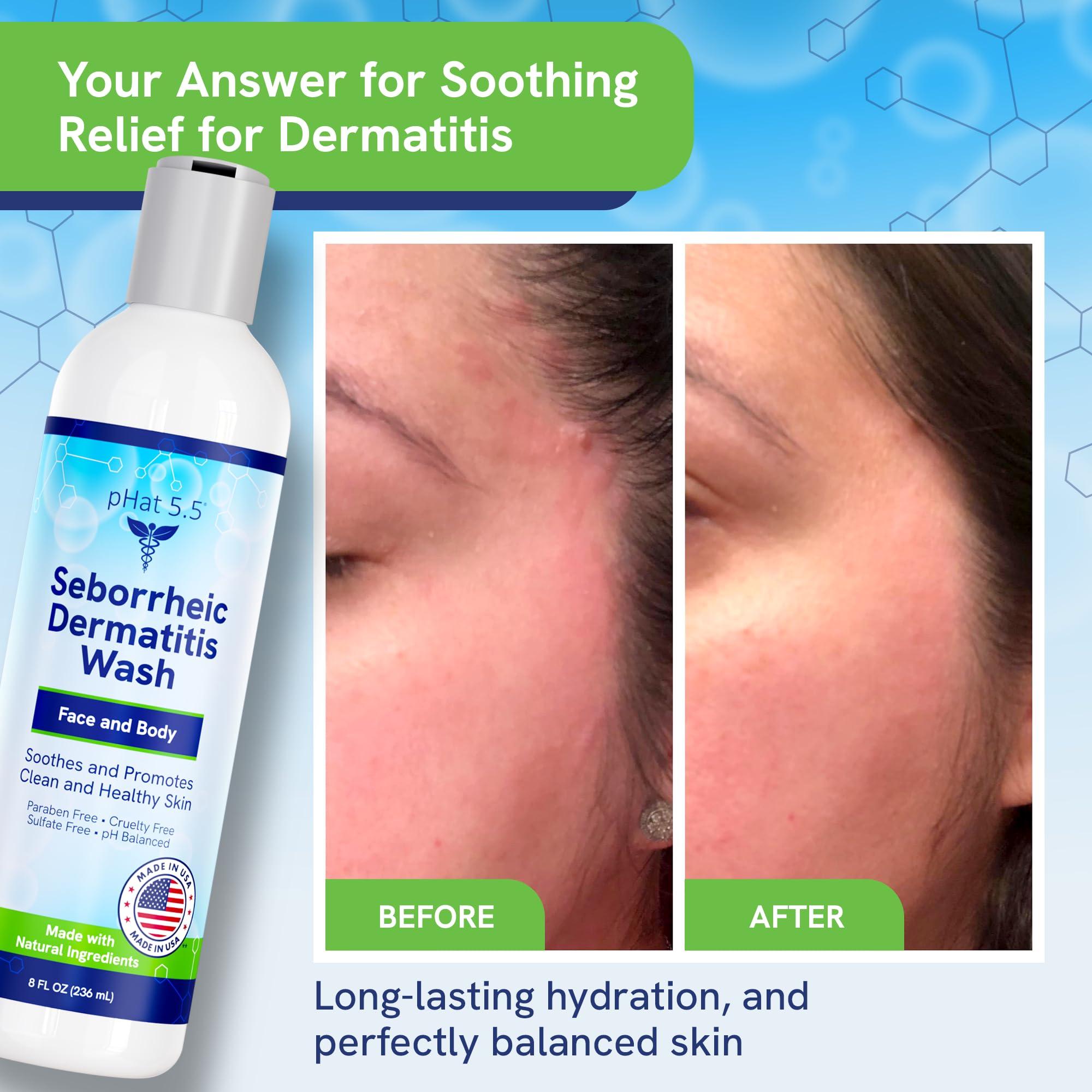 pHat 5.5 Seborrheic & Atopic Dermatitis Gentle Face Wash with Manuka Honey - Natural & Organic Face Cleanser & Body Wash For Sensitive Skin - Hypoallergenic, Paraben Free & Sulfate Free Acne Face Wash (8 oz)