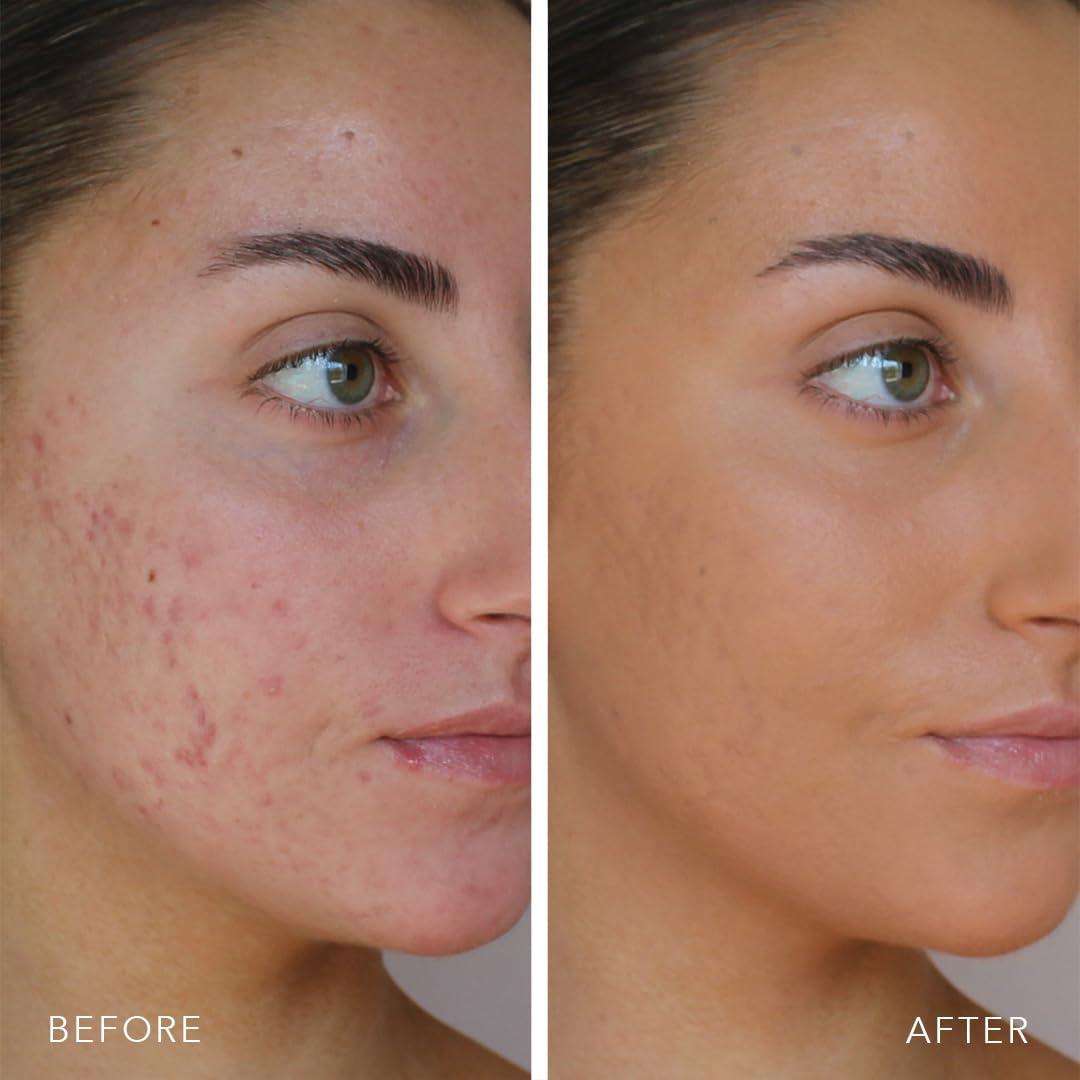 DOLL 10 NO. Doll 10 TCE Liquid Filter - Covers, Blurs, and Brightens (Deep)