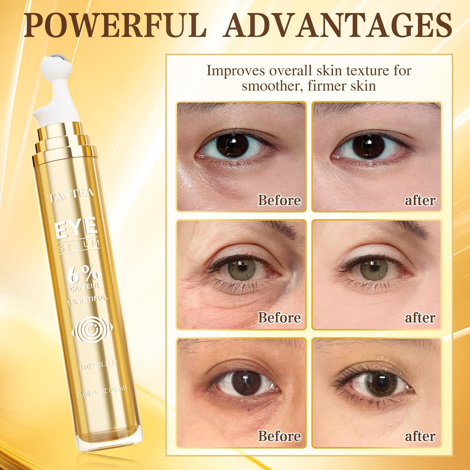 Tantea 6% Caffeine Eye Cream for Puffy Eyes & Dark Circles, 1% Retinol Eye Serum for Under Eye Bags, Anti-Aging Eye Treatment for Men and Women