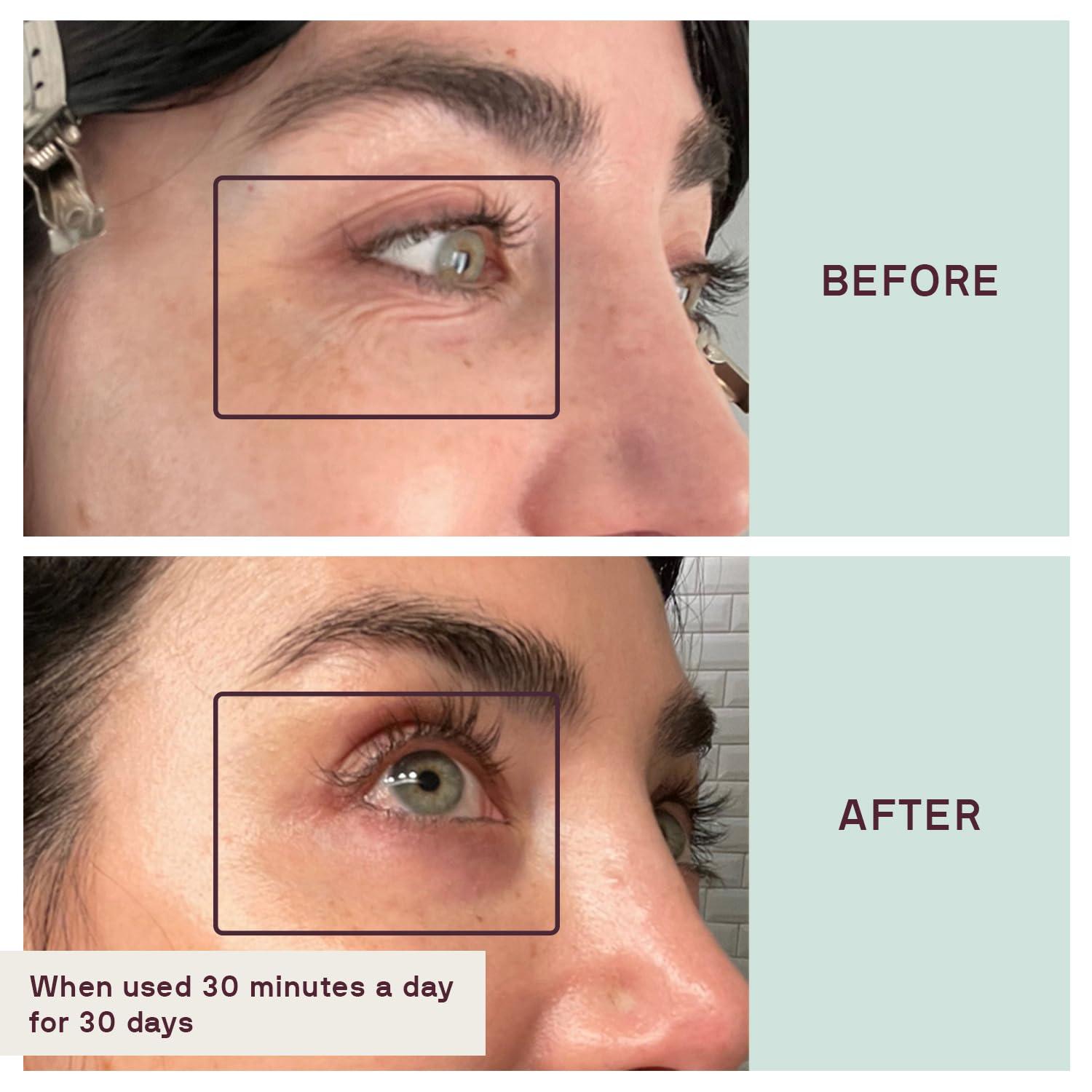 Dermaclara Dermaclara Silicone Face Patches - Anti-Wrinkle, Facial Mouth & Eye Patches - Hypoallergenic, Dermatologist Tested, Medical Grade Silicone Patches for Fine Lines & Wrinkles - Reusable up to 30 Uses