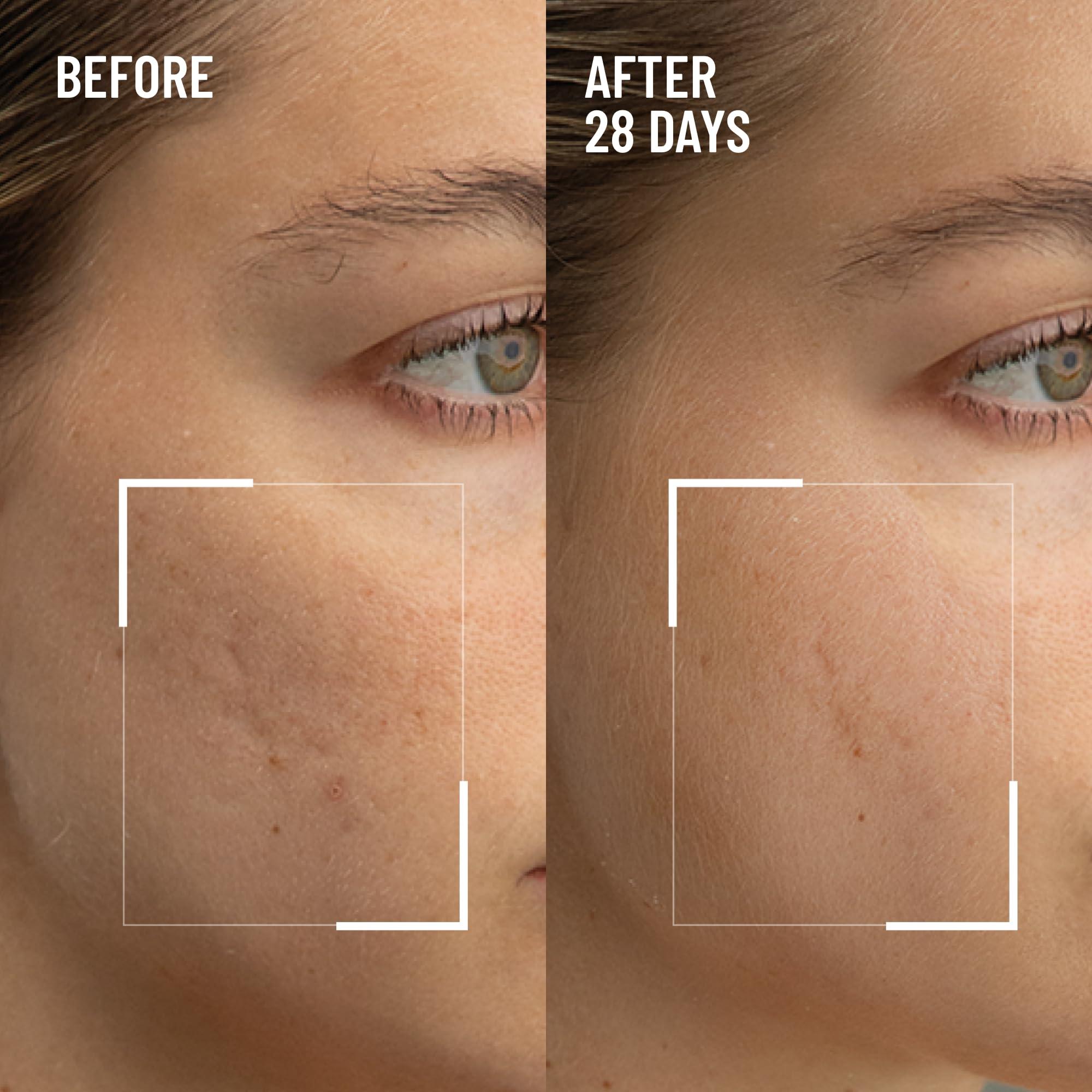 Dr. Brandt Skincare Dr. Brandt Microdermabrasion Renewing Face Exfoliator - Reduces Dull Skin, Uneven Texture, Fine Lines, Acne Scars & Wrinkles - 2.0 oz