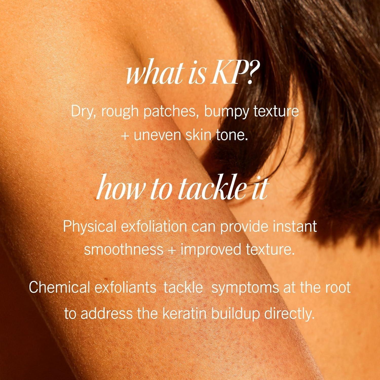 First Aid Beauty First Aid Beauty - KP Bump Eraser Body Scrub with 10% AHA, Keratosis Pilaris Skin Exfoliater with Glycolic and Lactic acids, Helps Reduce Chicken Skin Bumps, Safe for Sensitive Skin, 10 oz