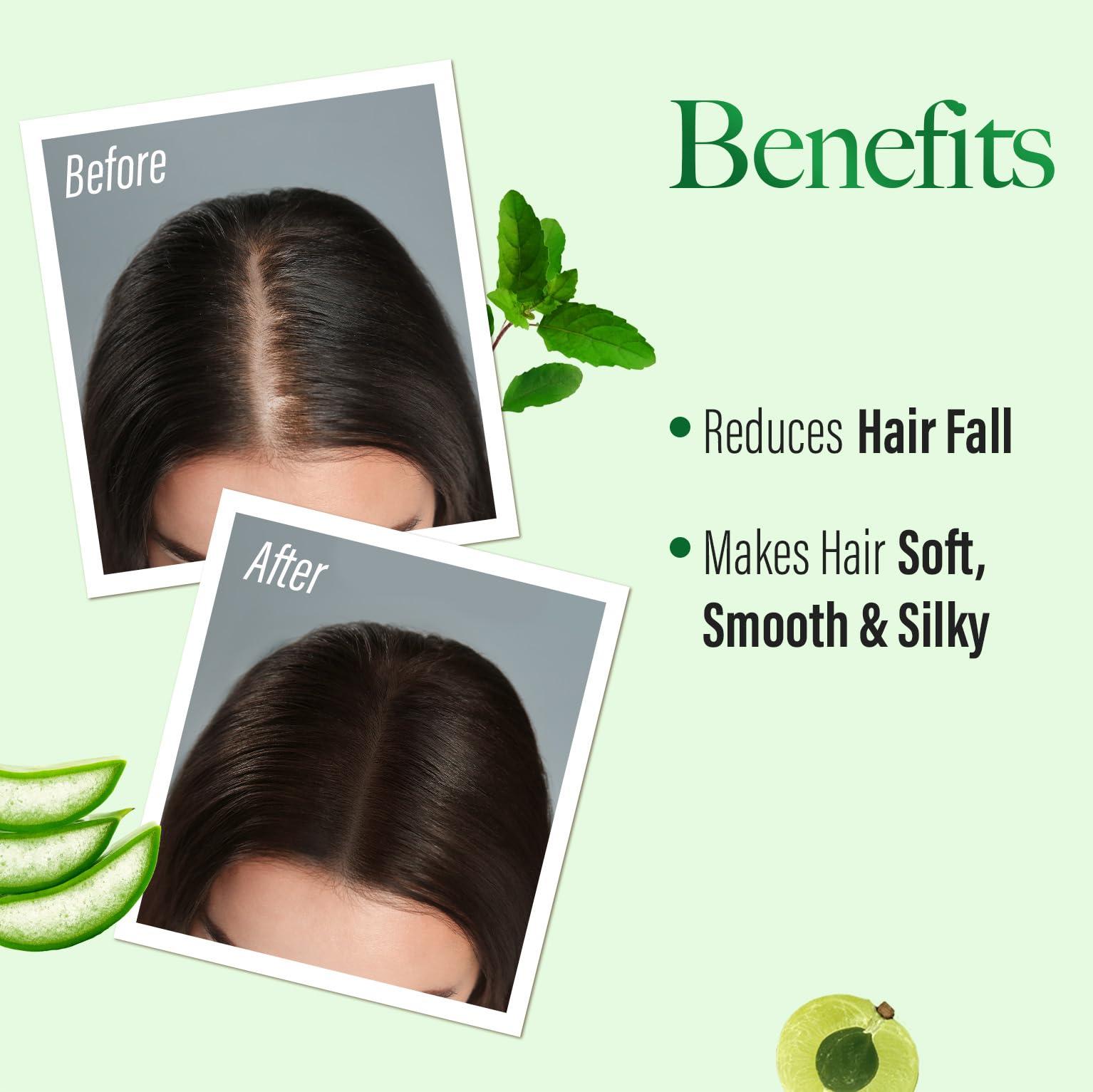 KESH KING KESH KING Anti Hairfall Shampoo | with 21 Ayurvedic Herbs & Aloe Vera | Provides Healthy Nourished Scalp | for Shiny & Smooth Hairs | 33.81. Fl Oz/1000ml