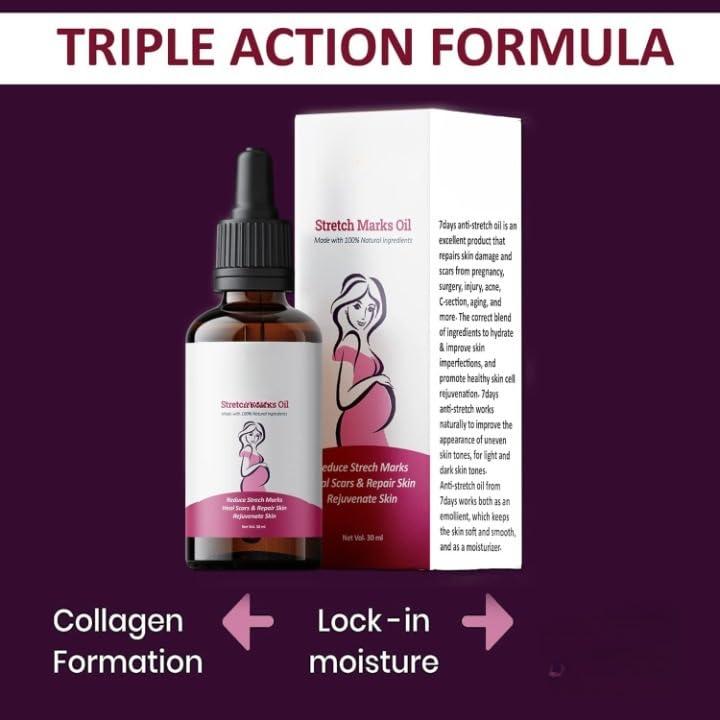 Generic Natural Stretch Mark Removal Cream 30 ml