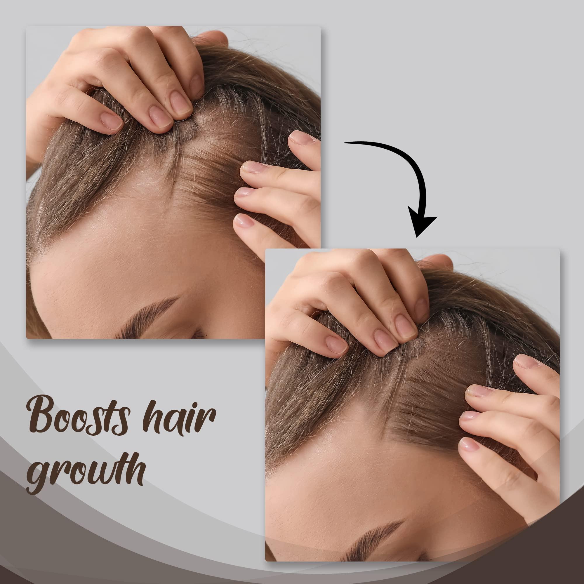 HerStyler HerStyler Castor Oil Hair Serum for Hair Growth - Hair Shine Serum with Vitamin E - Hair Growth Serum - Hair Serum Heat Protectant - Vitamin E Hair Serum for Silky Hair