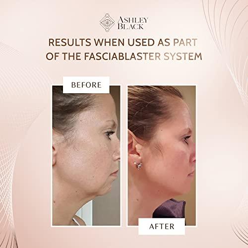 FasciaBlaster Jowls Kit by Ashley Black - For Firmness and Definition of the Jawline