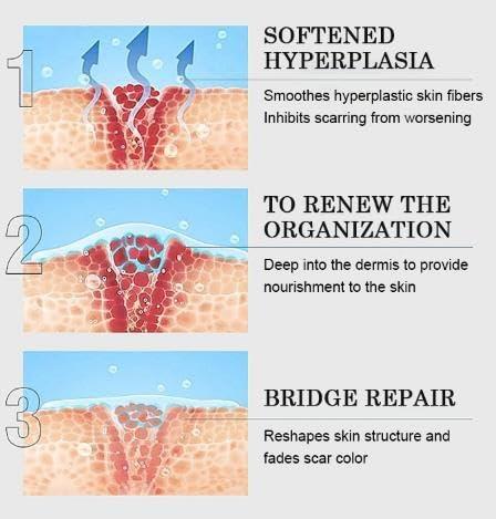 Generic Advanced Scar Cream Gel, Scar Removal Cream for Skin Face Body, Medical-Grade Silicone Gel Treatments for Keloid C-Section Acne Surgical Burns Stretch Marks - Old and New Scars 1.0 oz (1 PCS)