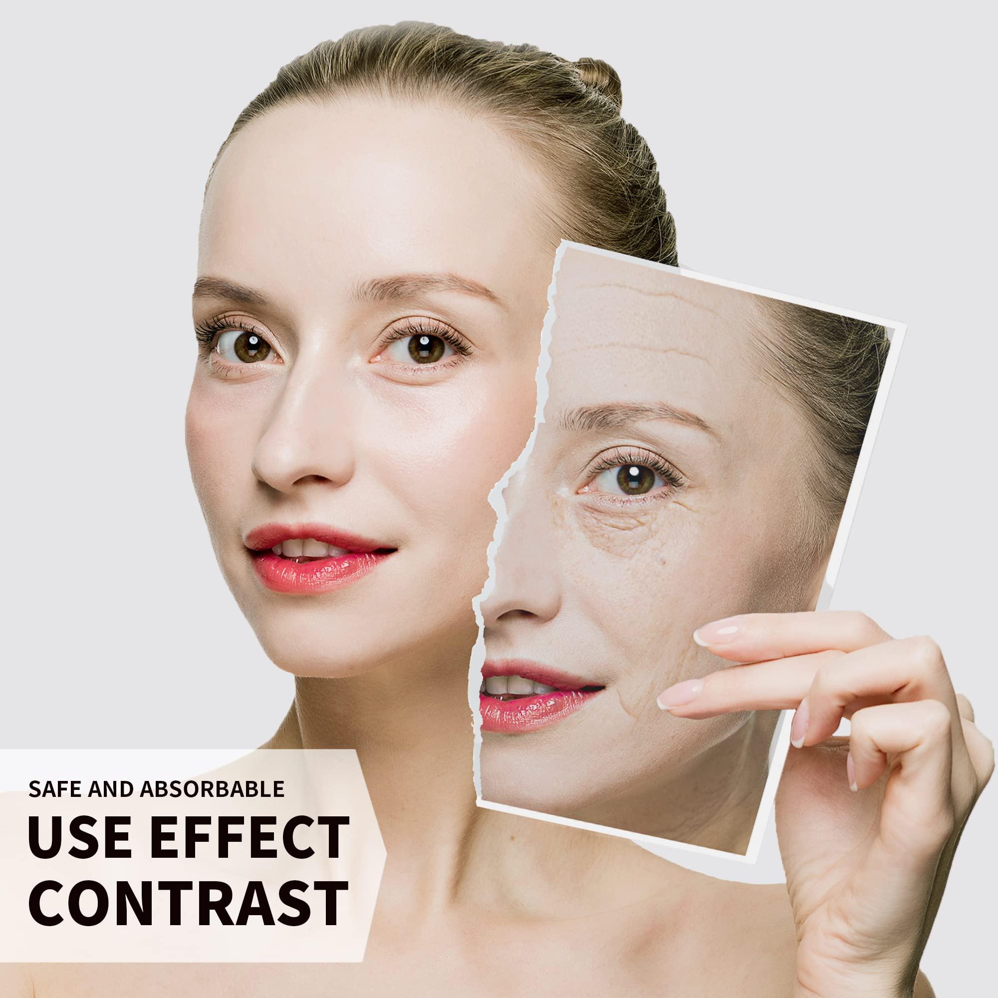 HYPOD HYPOD Pdo Multi Threads, Pdo Lifting Thread Promotes Blood Circulation, 23G38MM, 16 PCS