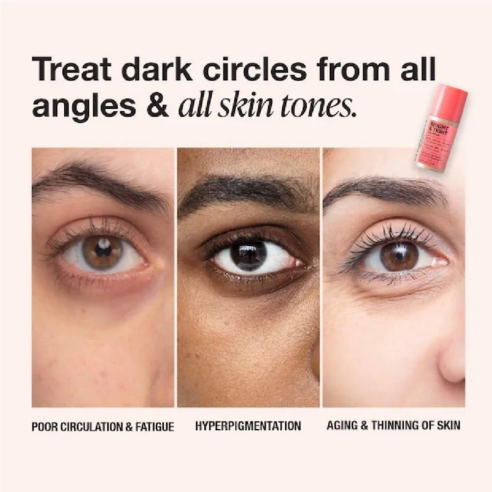 NAPH NAPH iNNBEAUTY PROJECT Bright & Tight Dark Circle Firming Eye Cream with Vitamin C & Peptides (0.5 oz / 15 mL) + Bonus Acne Patch (36 Pieces)