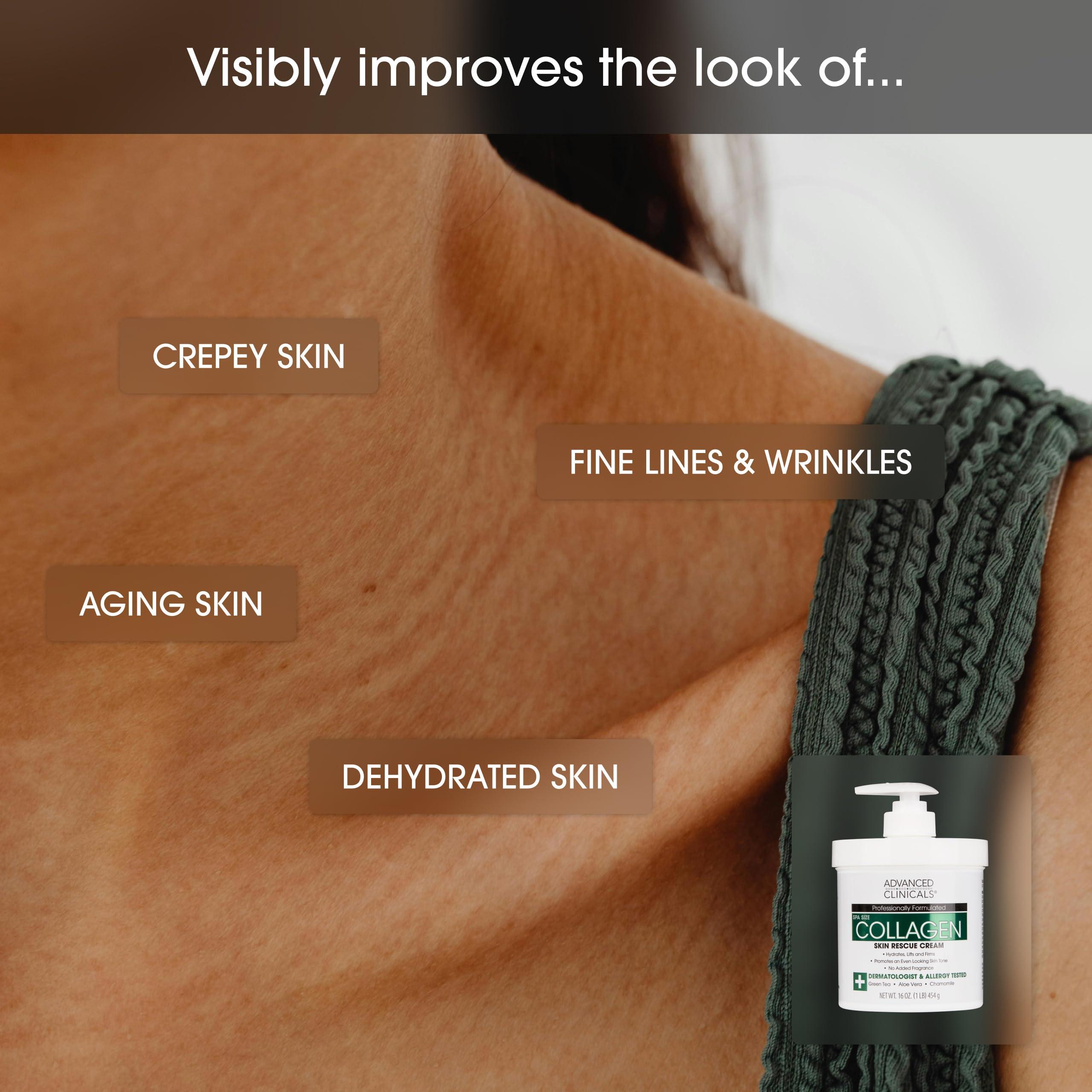 Advanced Clinicals Advanced Clinicals Collagen Skin Rescue Lotion