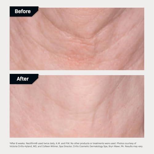 Revision Skincare Revision Skincare Nectifirm, Anti Aging Neck Firming Cream for Reducing Fine Lines, Wrinkles and Crepey Skin, 1.7 oz