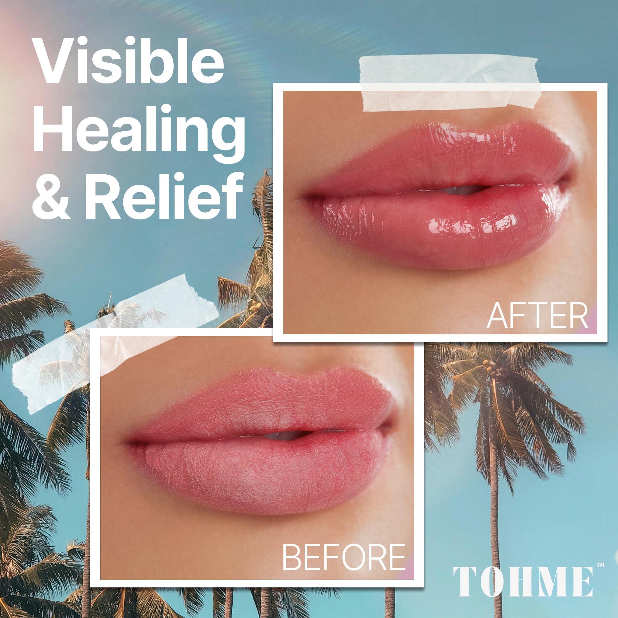 The Ocean Healed My Eczema The Ocean Healed My Eczema Nourishing & Hydrating Lip Balm - Naturally Soothing Lip Moisturizer for Eczema & Dry Cracked Lips - Moisturizing Lip Care with Mongongo Oil & Manuka Honey (.25 oz)