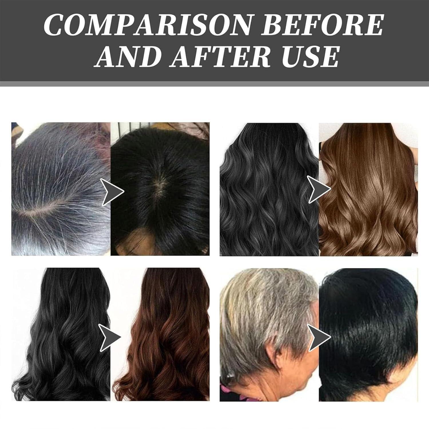 Aozonyoi Caviar Hair Colour Cream, Zhihuashi Bubble Dye Shampoo, Zhihuashi Caviar Protein Hair Dye, Zhihuashi Bubble Colour Hair Dye, Zhihuashi Herbal Plant Shampoo, Cover Gray Hair
