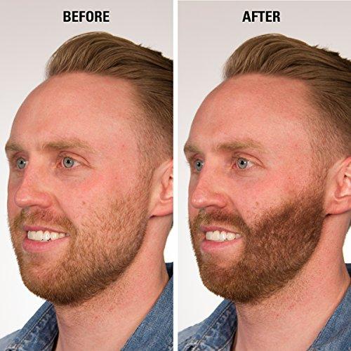 Eclipse Instant Hair Filler ECLIPSE Hair Fibers Dark Brown for Thinning Hair for Women & Men to Conceal Hair Loss in 15 Seconds - 100% Undetectable Hair Building Fibers, 15g