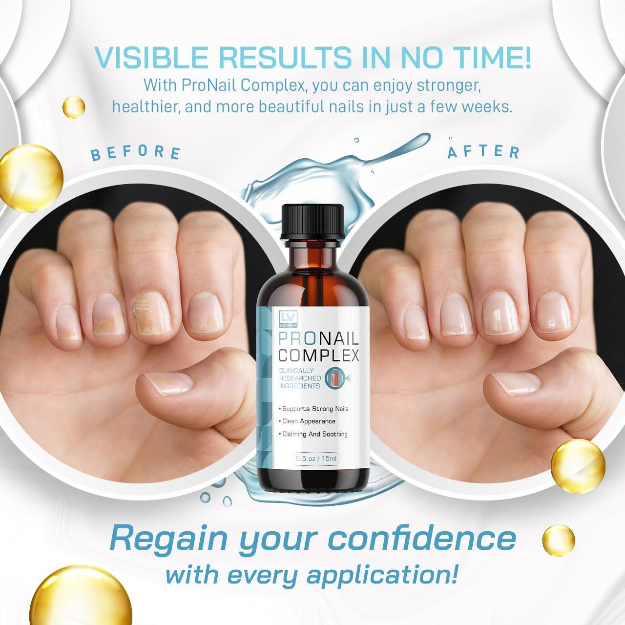 LIVORKA 3 Pack - ProNail Complex, Pronail, Pronail Complex Oil, ProNailComplex, Pro Nail, Pro Nail Complete, ProNailComplex 24, Pro Nail Complex for 3 Bottles for 90 Days