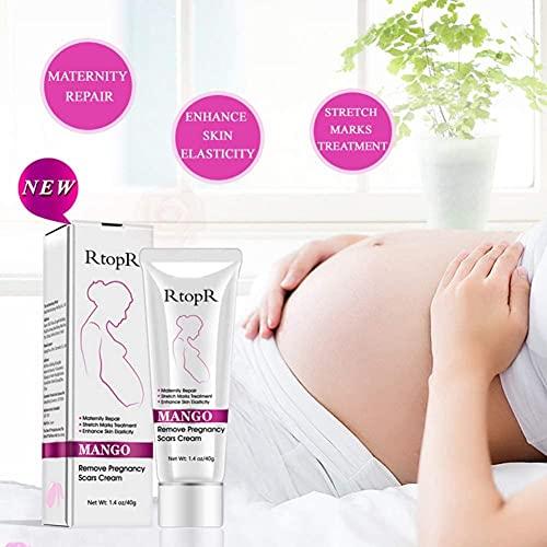 MQUPIN RtopR Mango Stretch Marks and Scar Cream -Stretch Marks and Scar Removal Cream for Pregnancy - Best Body Moisturizer-40g