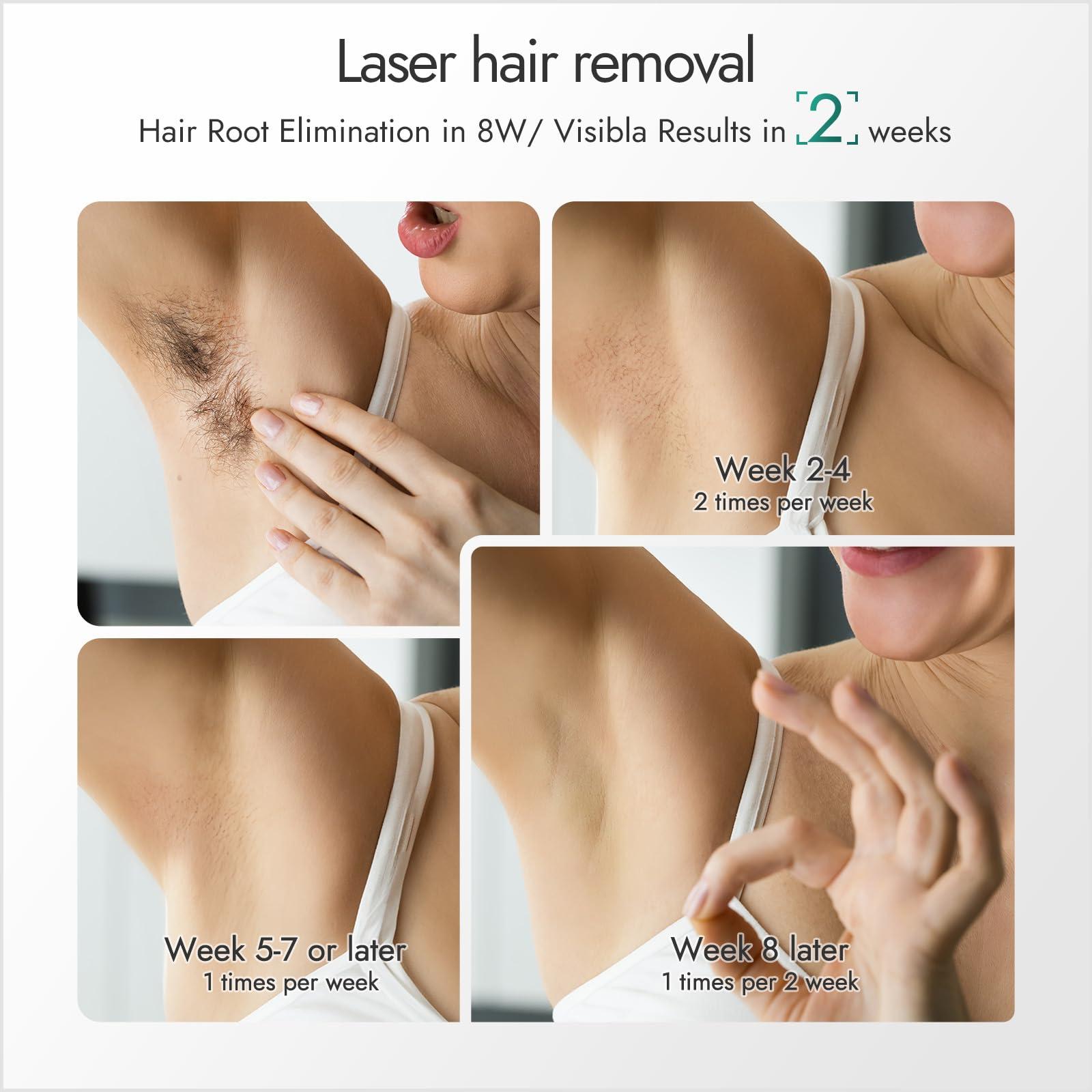 Sextupole IPL Laser Hair Removal for Woman and Men,Sextupole Hair Removal Device with Ice Cooling Care Function, Visible Results in 2 Weeks, Laser Hair Removal Care Painless Safe Gentle at Home Full Body,Green