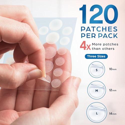KEYCONCEPTS PatchRx Pimple Patches for Face (120 Patches), Hydrocolloid Acne Patches with Tea Tree Oil, Pimple Patch Pimple Stickers - Hydrocolloid Patch Acne Dots - Acne Pimple Patches For Face - Zit Patches