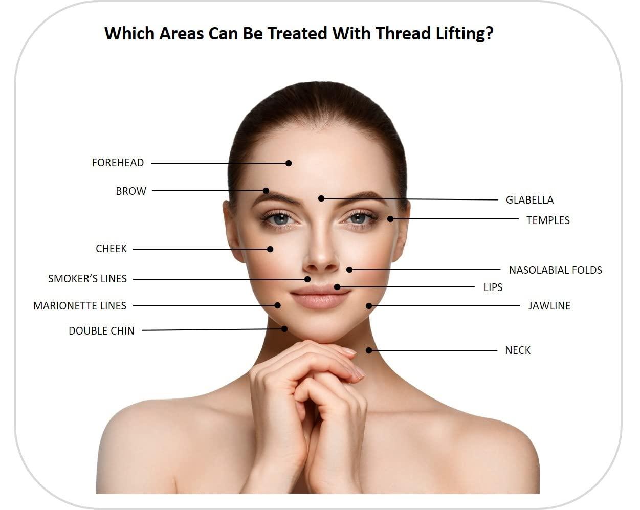 CRD Eye Care - ACE PDO thread lift KOREA - Mono Type/Blunt 30G25 (20pcs) for Eye Care (30G25/35)