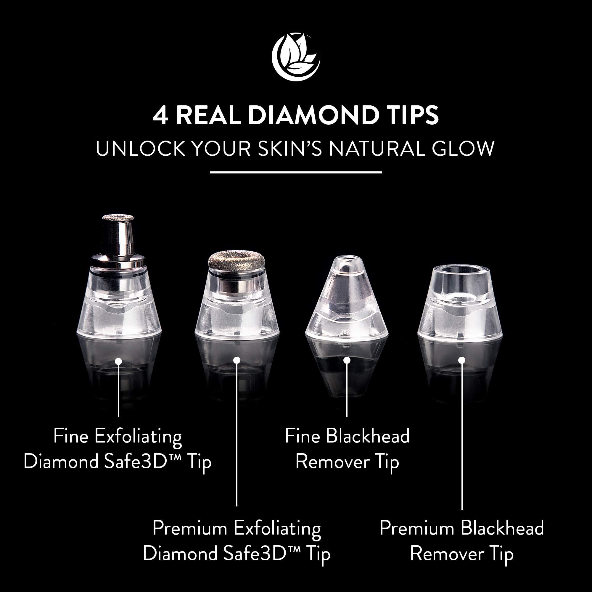 Microderm GLO Microderm GLO Mini Diamond Microdermabrasion and Suction Tool and Accessories Bundle