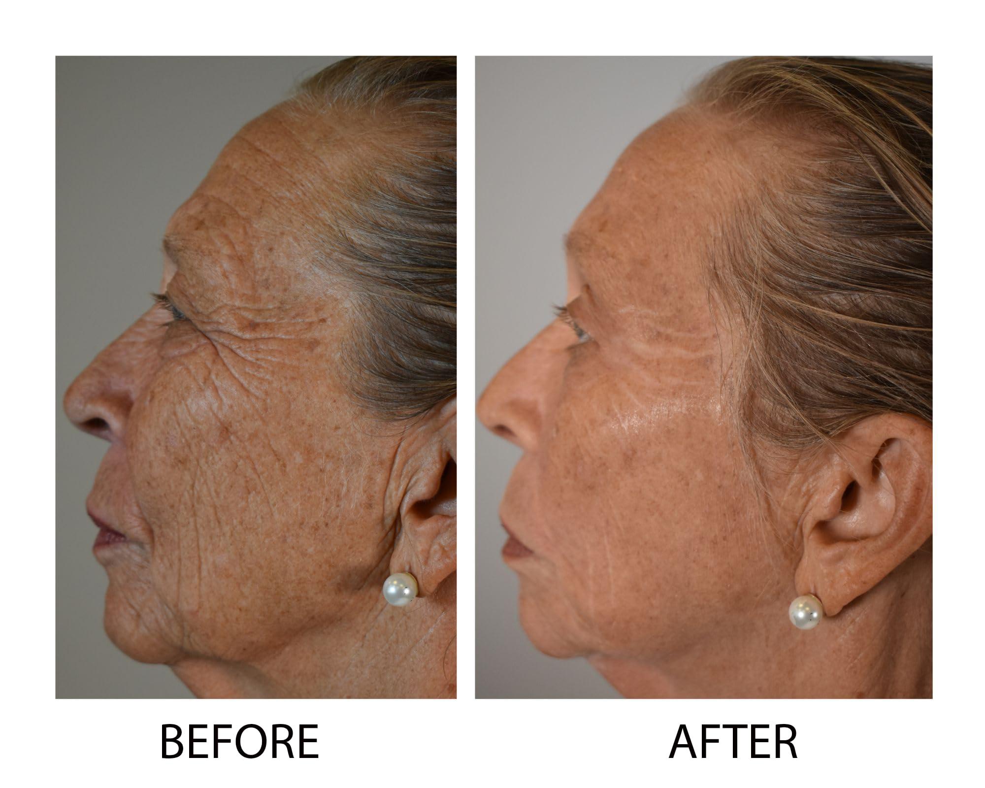 Dr.Sevinor Skincare Solutions Dr Sevinor Wrinkle Solution Wrinkle Smoothing Tinted Serum 1 FL OZ