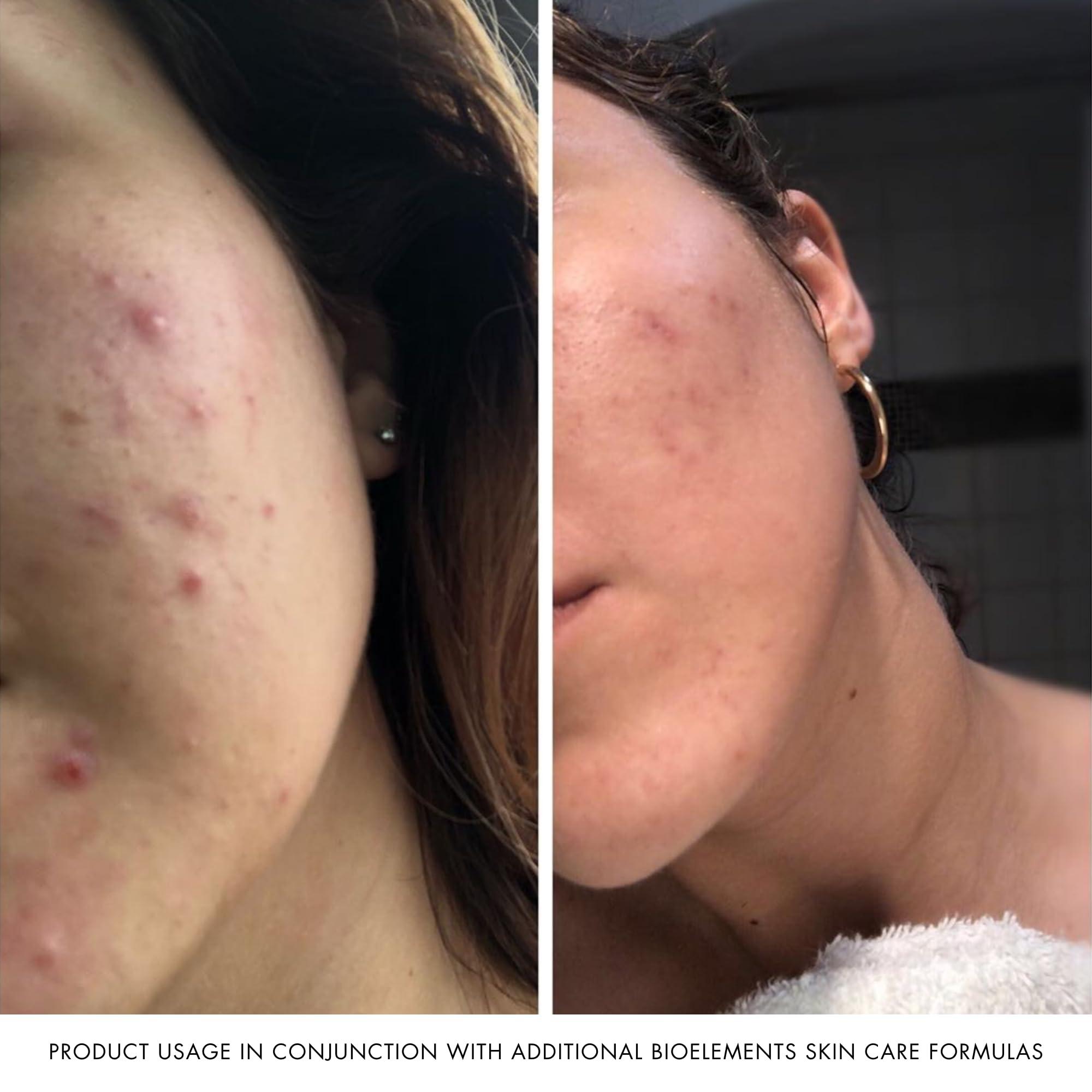 Bioelements Bioelements Crucial Moisture - 2.5 fl oz - Emollient Cream Facial Moisturizer for Dry Skin - Improve Fine Lines - Vegan, Gluten Free - Never Tested on Animals, 2.5 Fl Oz (Pack of 1)