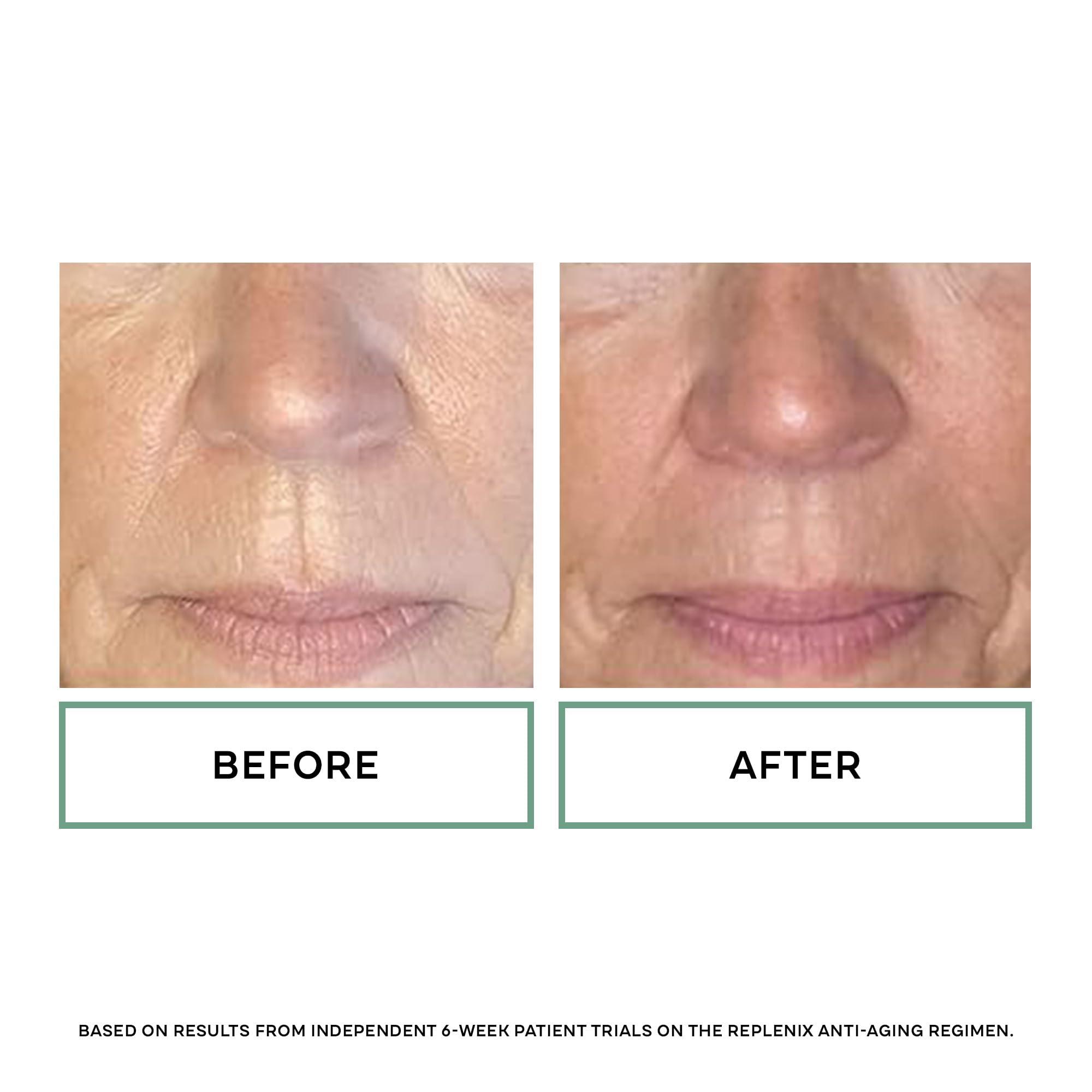 Replenix Replenix Antioxidant Hydrating Cleanser, Medical-Grade Gentle Face Wash for Dry & Mature Skin (6 fl. Oz)