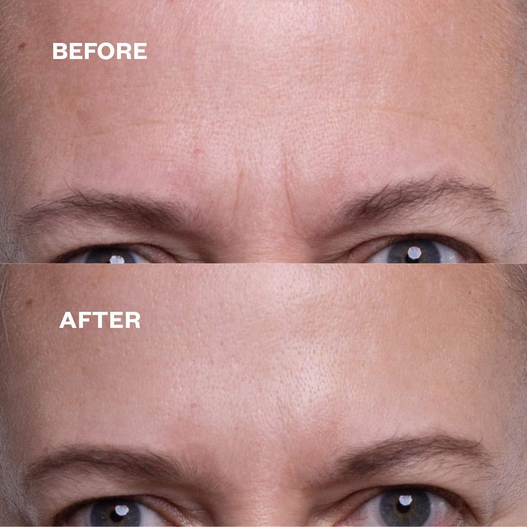 Wrinkles Schminkles Wrinkles Schminkles Faux-Tox Face Set: Silicone Patch Cleanser, Forehead Wrinkle Patches & Under Eye Wrinkle Patches