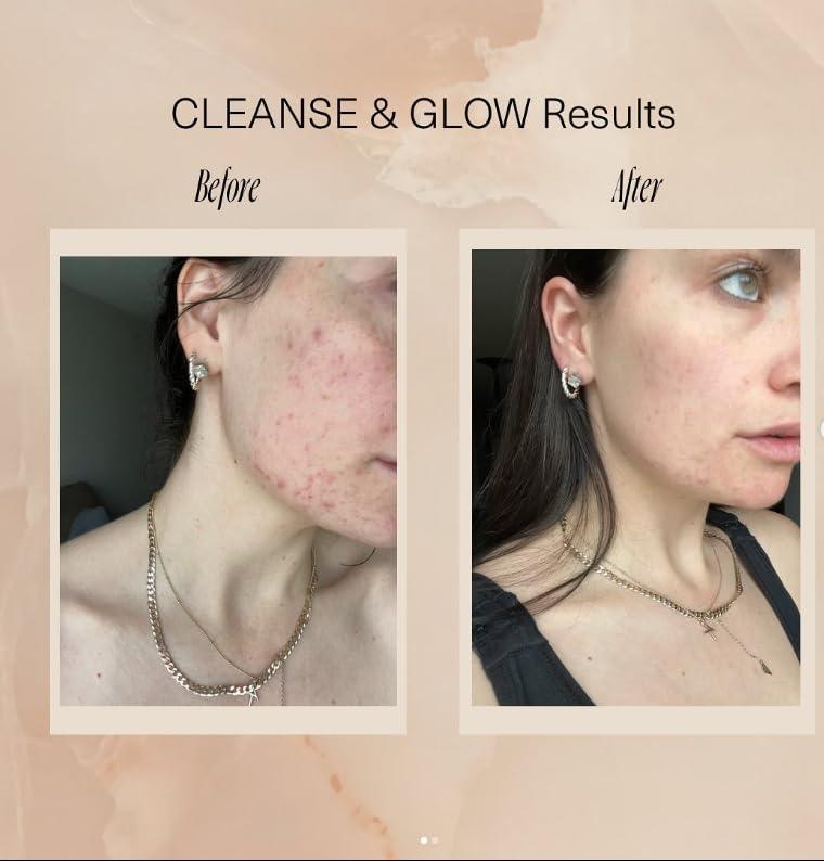 Aloisia Beauty Aloisia Beauty CLEANSE & GLOW MINI Set