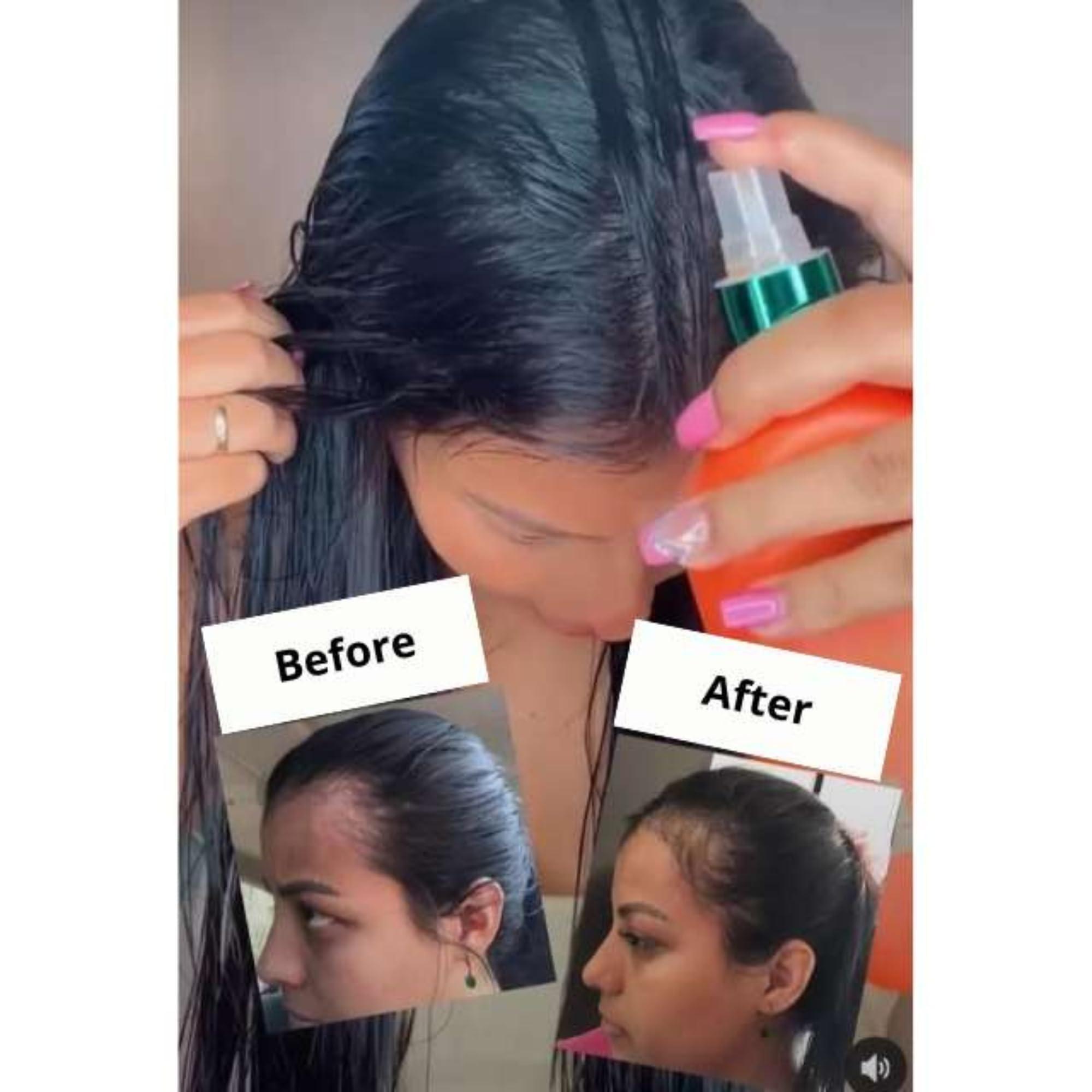 Generic Gold Spell Tonico Poderoso - Powerful Hair Tonic - 250ml (8.45 oz) | Hair Strengthening & Anti-Hair Loss Treatment | Original from Brazil