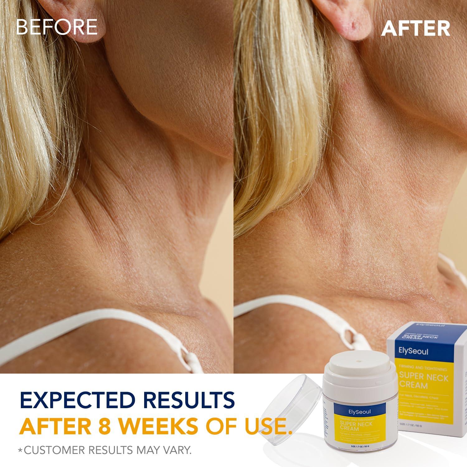 ElySeoul ElySeoul Korean Neck Cream for Firming & Tightening: Neck & Chest Anti-Aging Treatment for Crepey Sagging Skin & Wrinkles - Women & Men Turkey Neck Perfecting, 1.7 oz