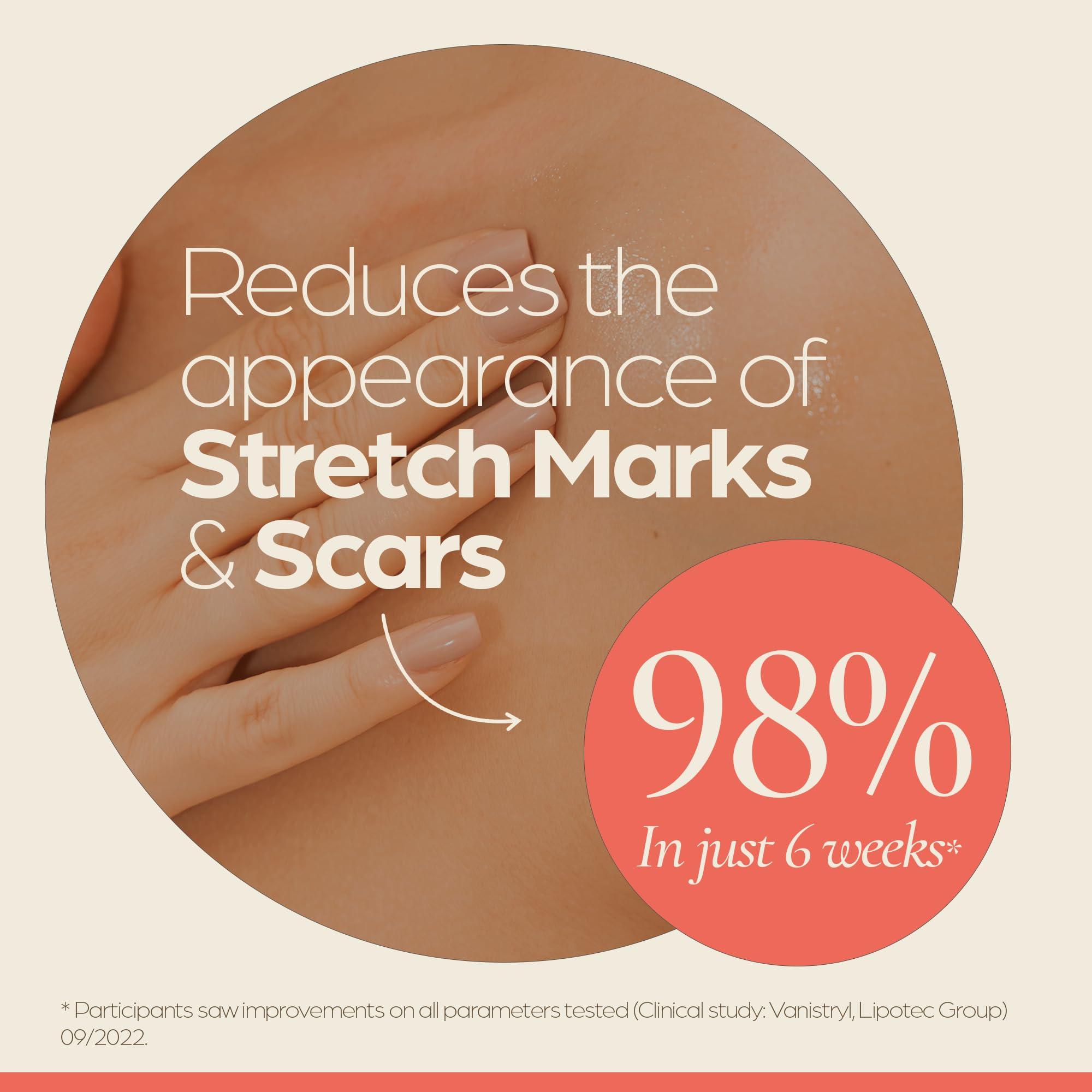 COCOBABA BY EMMA HEMING WILLIS Coconut Stretch Mark Oil (4oz) | Non Greasy | Belly Oil for Pregnancy | Paraben-Free | Pregnancy Stretch Mark Prevention | Stretch Marks Cream | Belly Oil for Pregnancy Prevent Stretch Marks