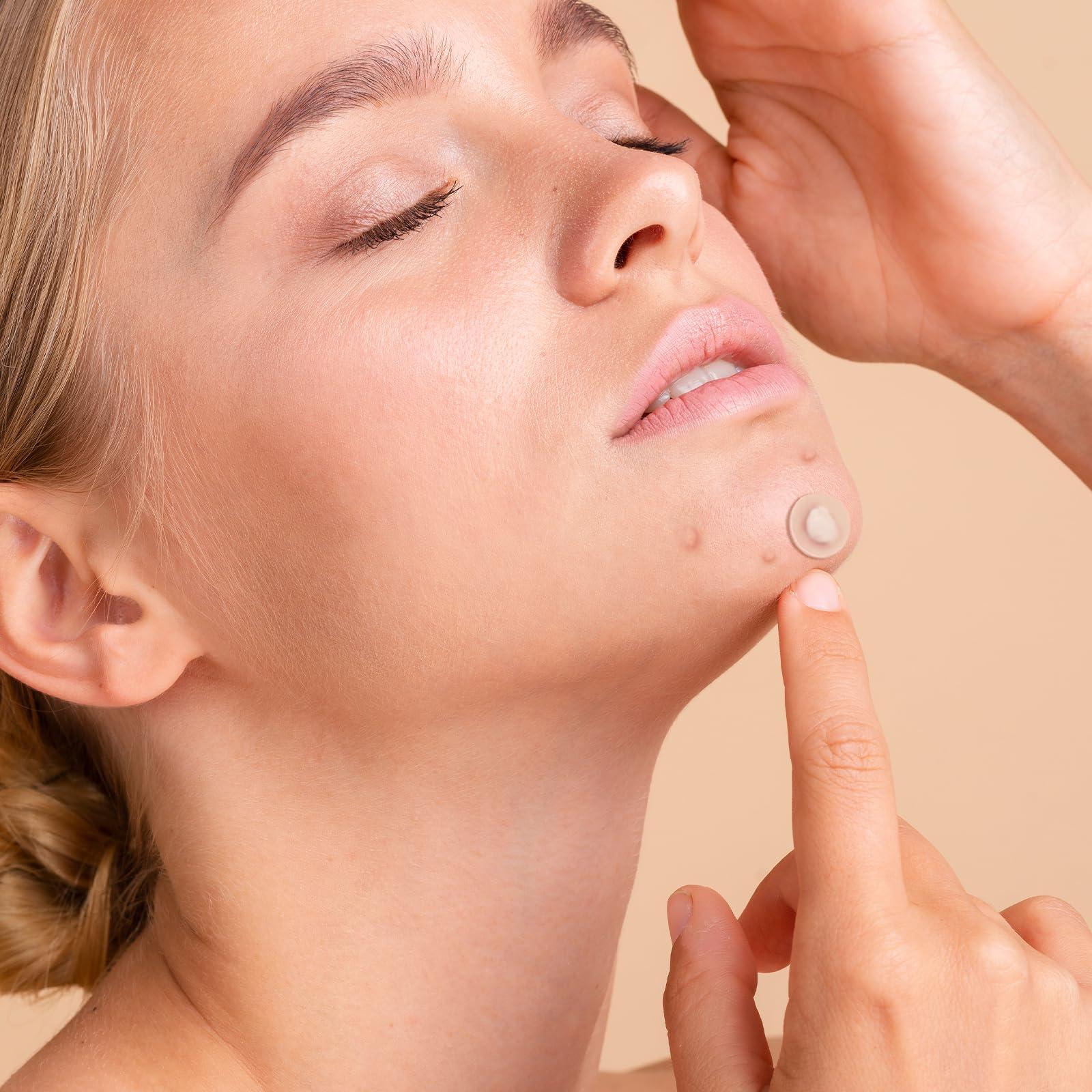 Qmakup Qmakup Pimple Patches for Face,Acne Patches for Face,Pimple Patch,Zit Patches,Hydrocolloid Blemish Patches for Covering Zits and Blemishes,with Salicylic Acid,Tea Tree oil & Calendula oil, 108 Counts