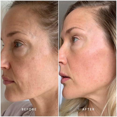 True Botanicals True Botanicals Anti-Aging Essentials | Increase Hydration, Treat Fine Lines & Wrinkles | Contains Chebula Active Serum, Renew Pure Radiance Oil, and Phyto Retinol Advanced Clinical Cream