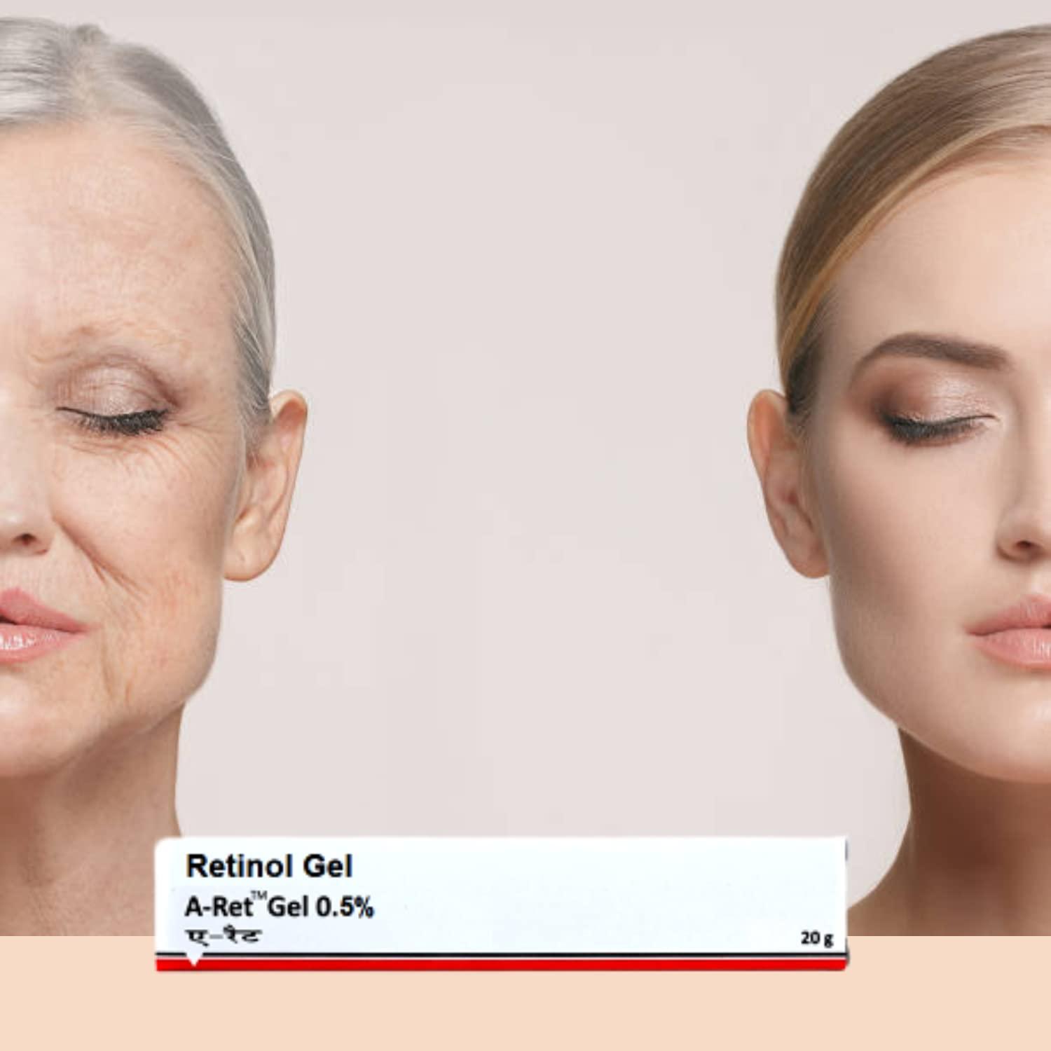 Organic Herbs Retinol Gel 0.05 Vitamin A Repairs Fine Lines & Wrinkles, Scar Treatment Age and Sun Spots Anti-Aging Formula, 20 Grams (Retinol Gel 0.05)